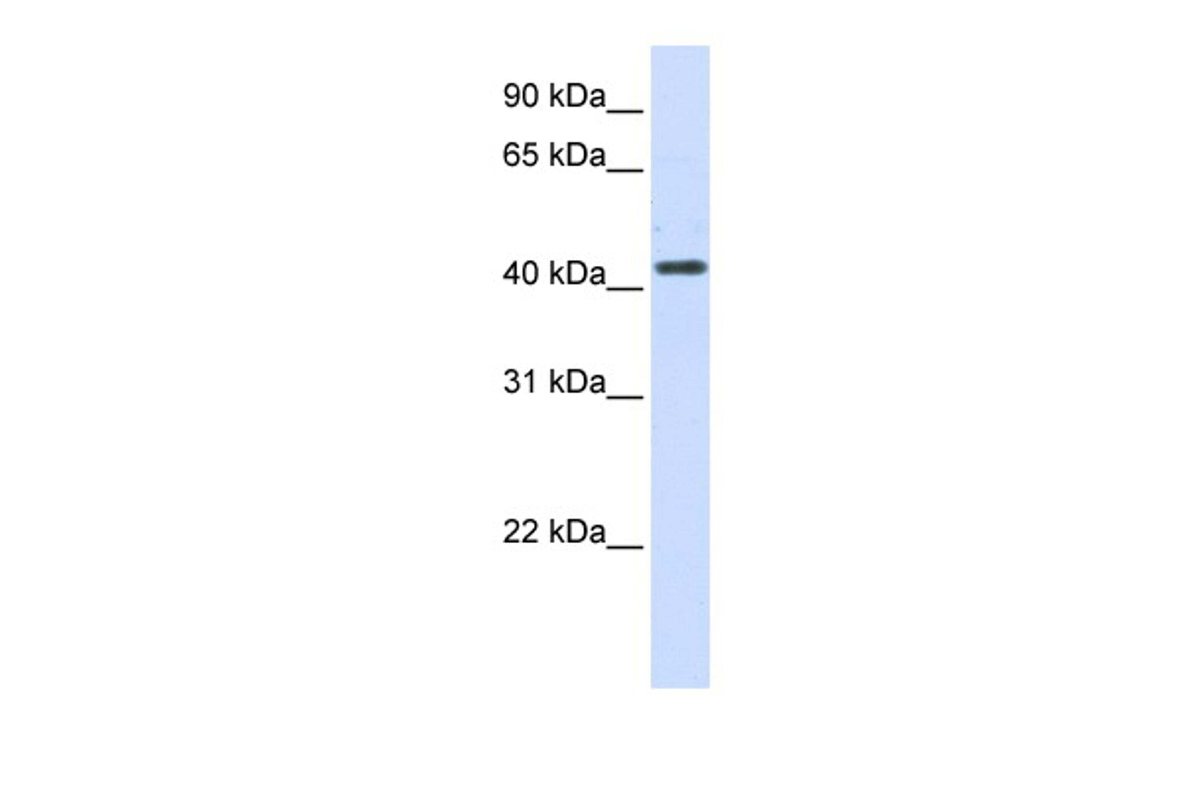 Antibody used in WB on Human 293T at 0.2-1 ug/ml.