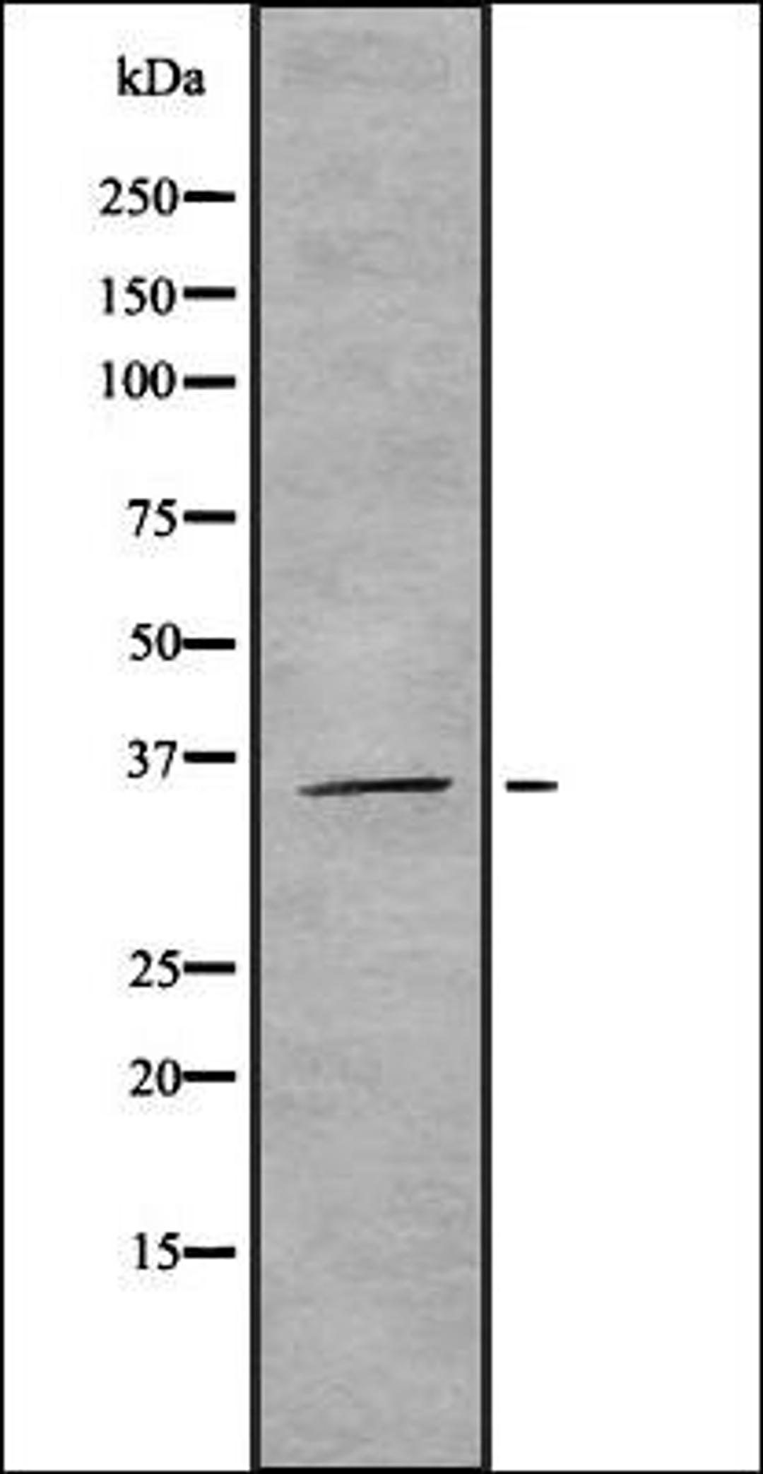 Western blot analysis of HEK293 cells using ROAA antibody