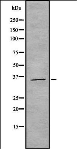 Western blot analysis of HEK293 cells using ROAA antibody