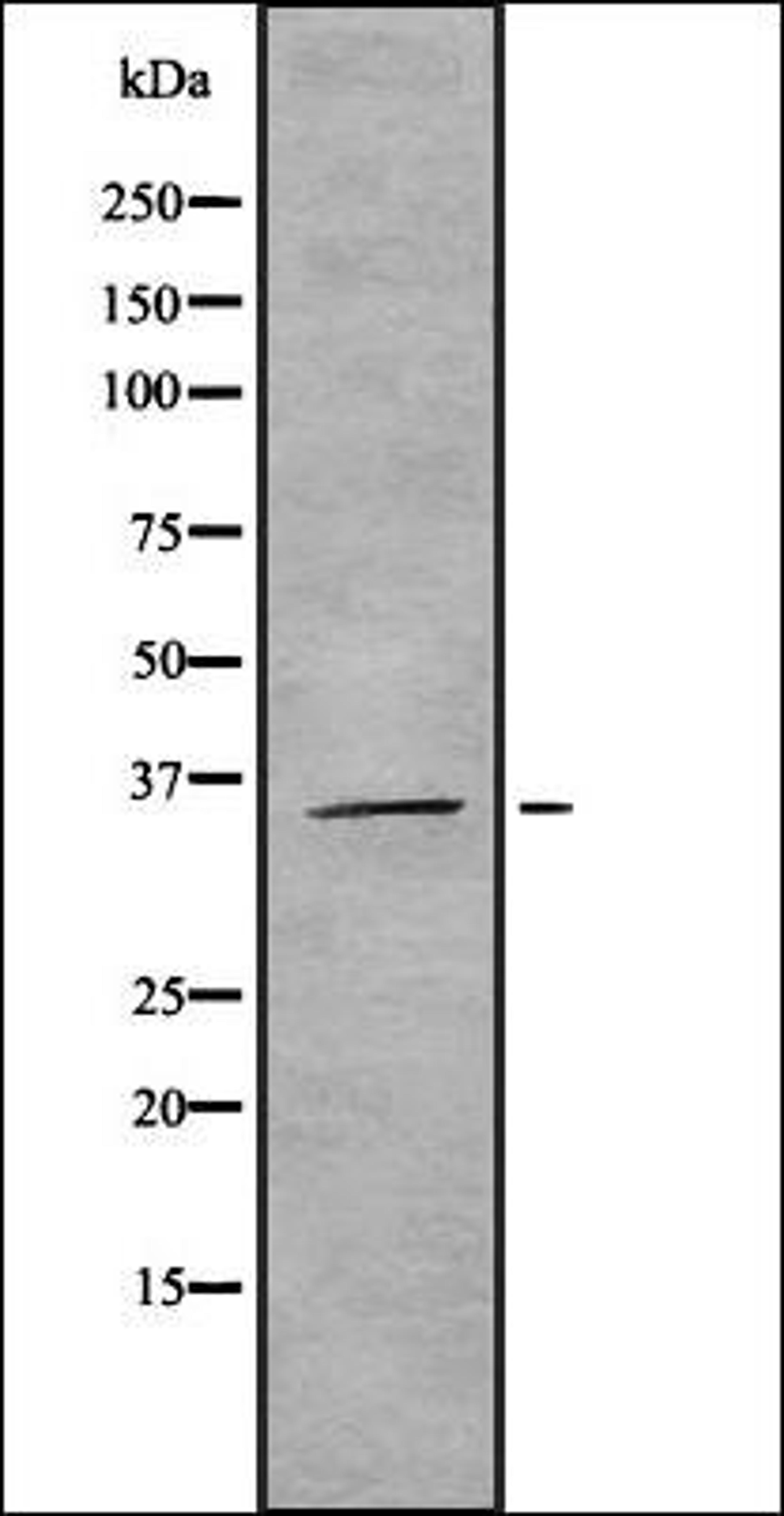 Western blot analysis of HEK293 cells using ROAA antibody