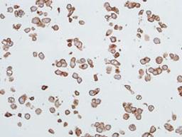 Detection of human CEACAM1 in FFPE Hep-G2 cells by ICC.