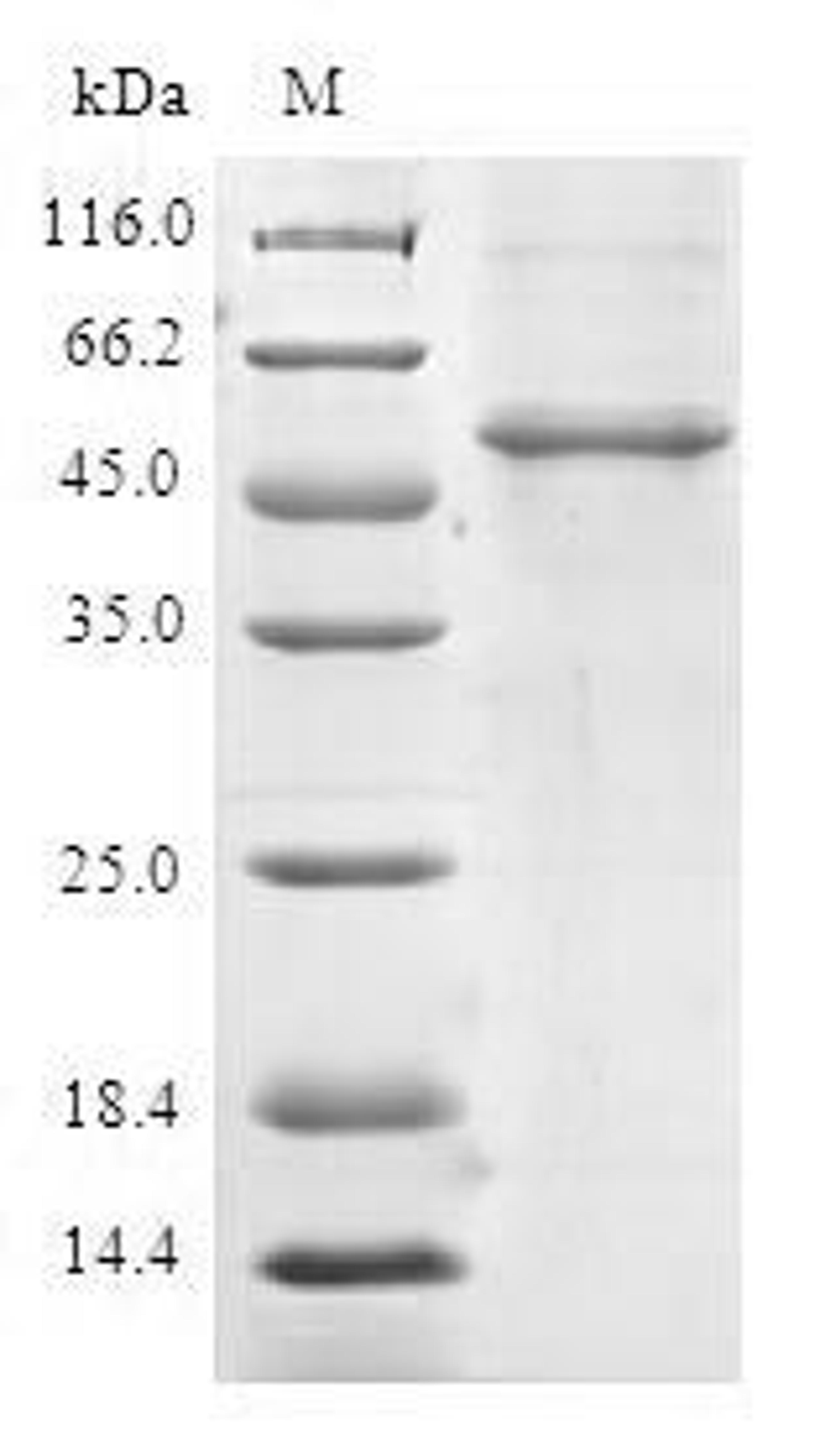 (Tris-Glycine gel) Discontinuous SDS-PAGE (reduced) with 5% enrichment gel and 15% separation gel.