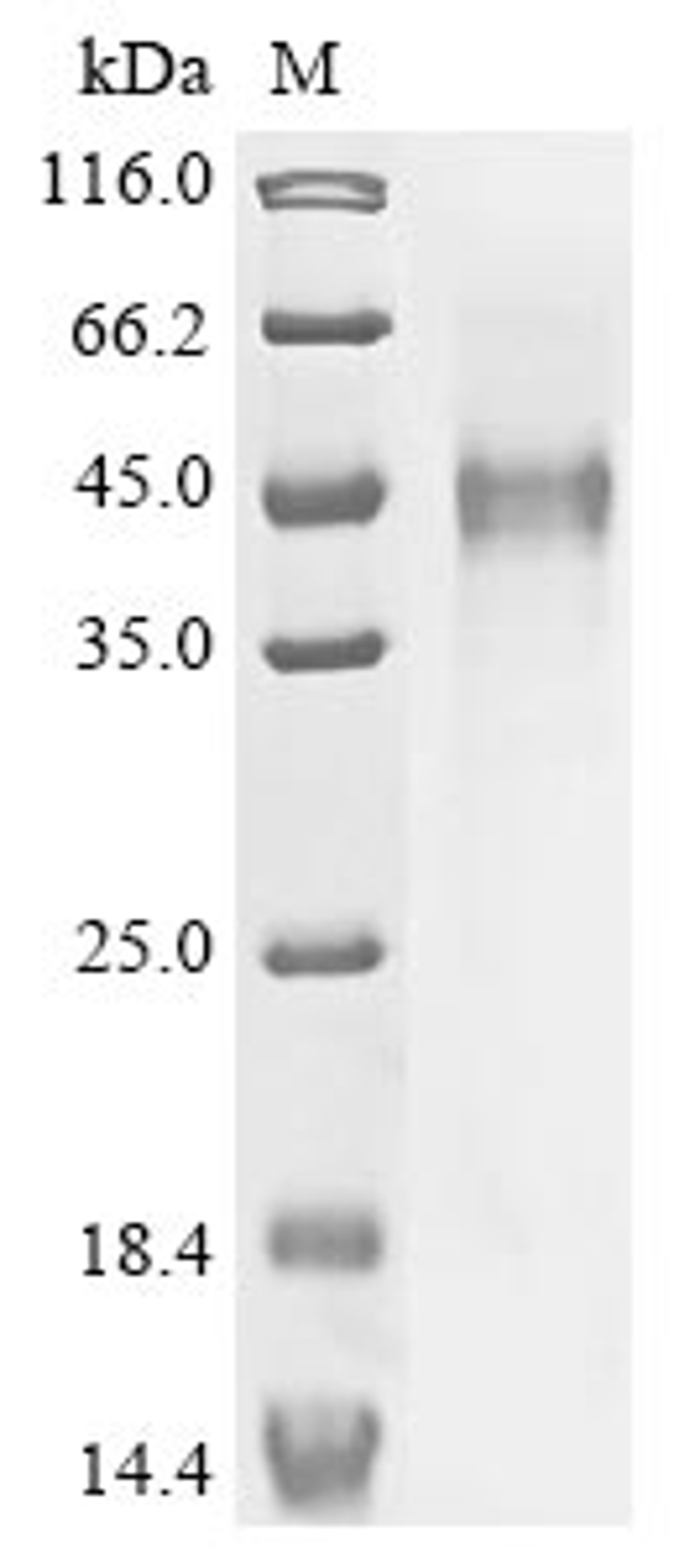 (Tris-Glycine gel) Discontinuous SDS-PAGE (reduced) with 5% enrichment gel and 15% separation gel.