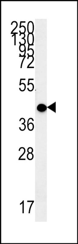 Western blot analysis in WiDr cell line lysates (15ug/lane).