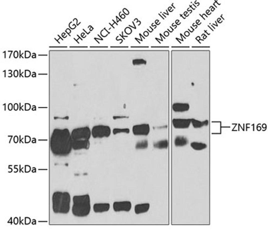 Western blot - ZNF169 antibody (A7486)