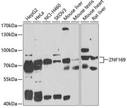 Western blot - ZNF169 antibody (A7486)