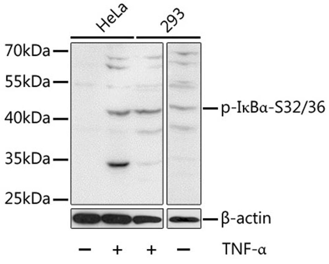 Western blot - Phospho-I?Ba-S32/36 antibody (AP0614)