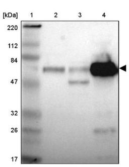 Western Blot: Alpha 1 Antichymotrypsin Antibody [NBP1-90295] - Lane 1: Marker [kDa] 220, 112, 84, 47, 32, 26, 17<br/>Lane 2: Human cell line RT-4<br/>Lane 3: Human cell line U-251MG sp<br/>Lane 4: Human plasma (IgG/HSA depleted)