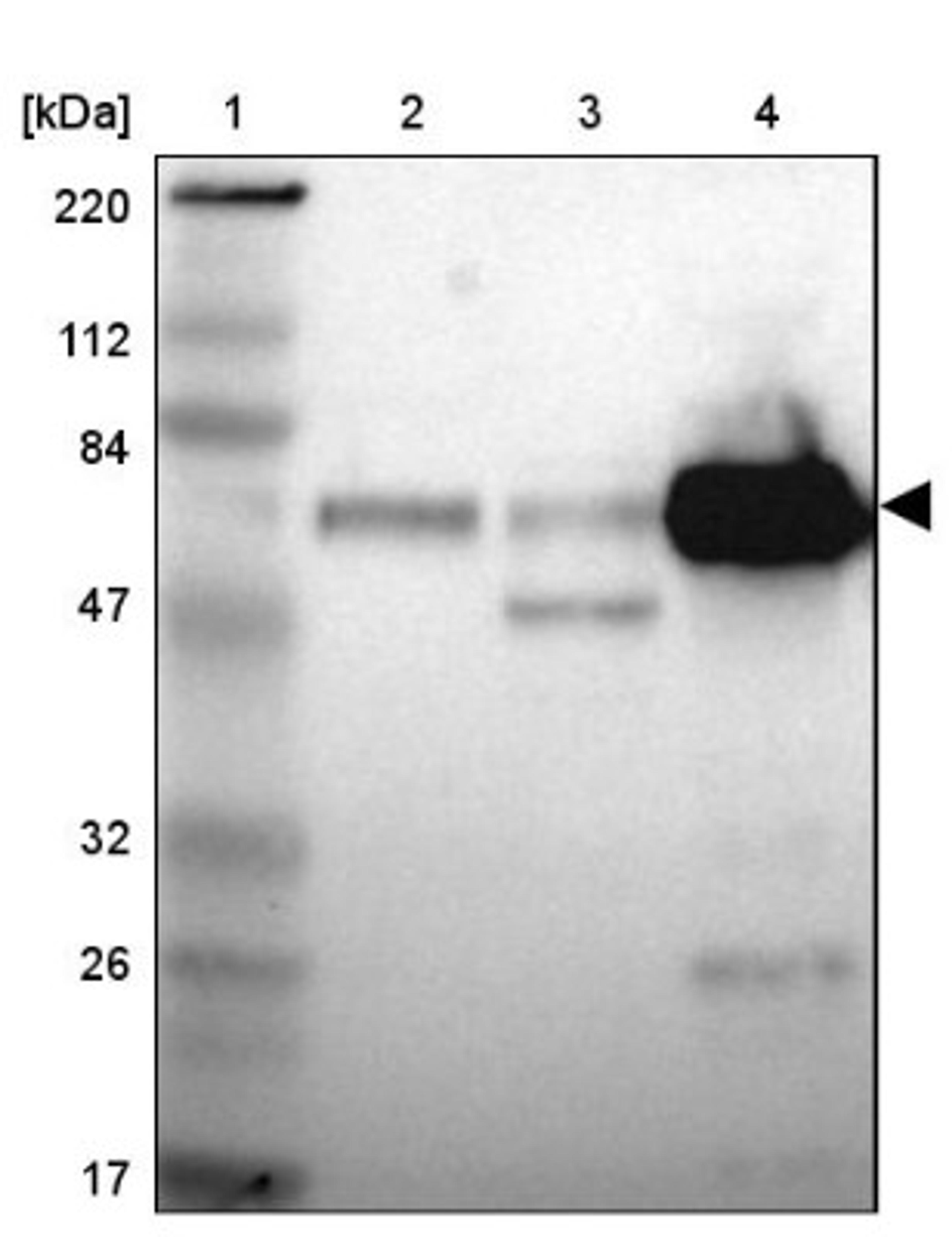 Western Blot: Alpha 1 Antichymotrypsin Antibody [NBP1-90295] - Lane 1: Marker [kDa] 220, 112, 84, 47, 32, 26, 17<br/>Lane 2: Human cell line RT-4<br/>Lane 3: Human cell line U-251MG sp<br/>Lane 4: Human plasma (IgG/HSA depleted)