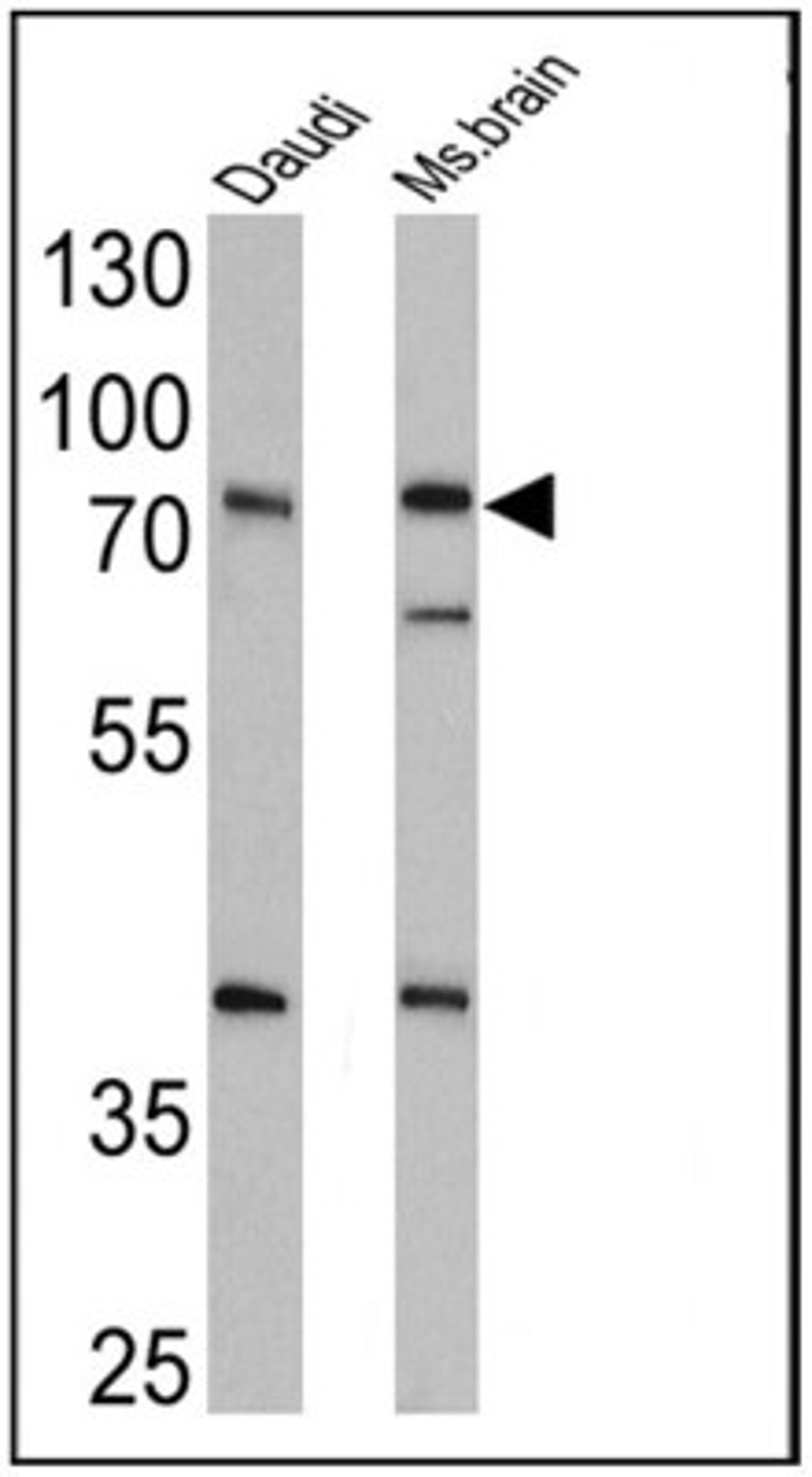 Western Blot: epithelial Sodium Channel alpha Antibody [NB100-74357] - Analysis of 25 ug of Daudi (lane 1) and mouse brain (lane 2) cell lysates onto an SDS polyacrylamide gel.