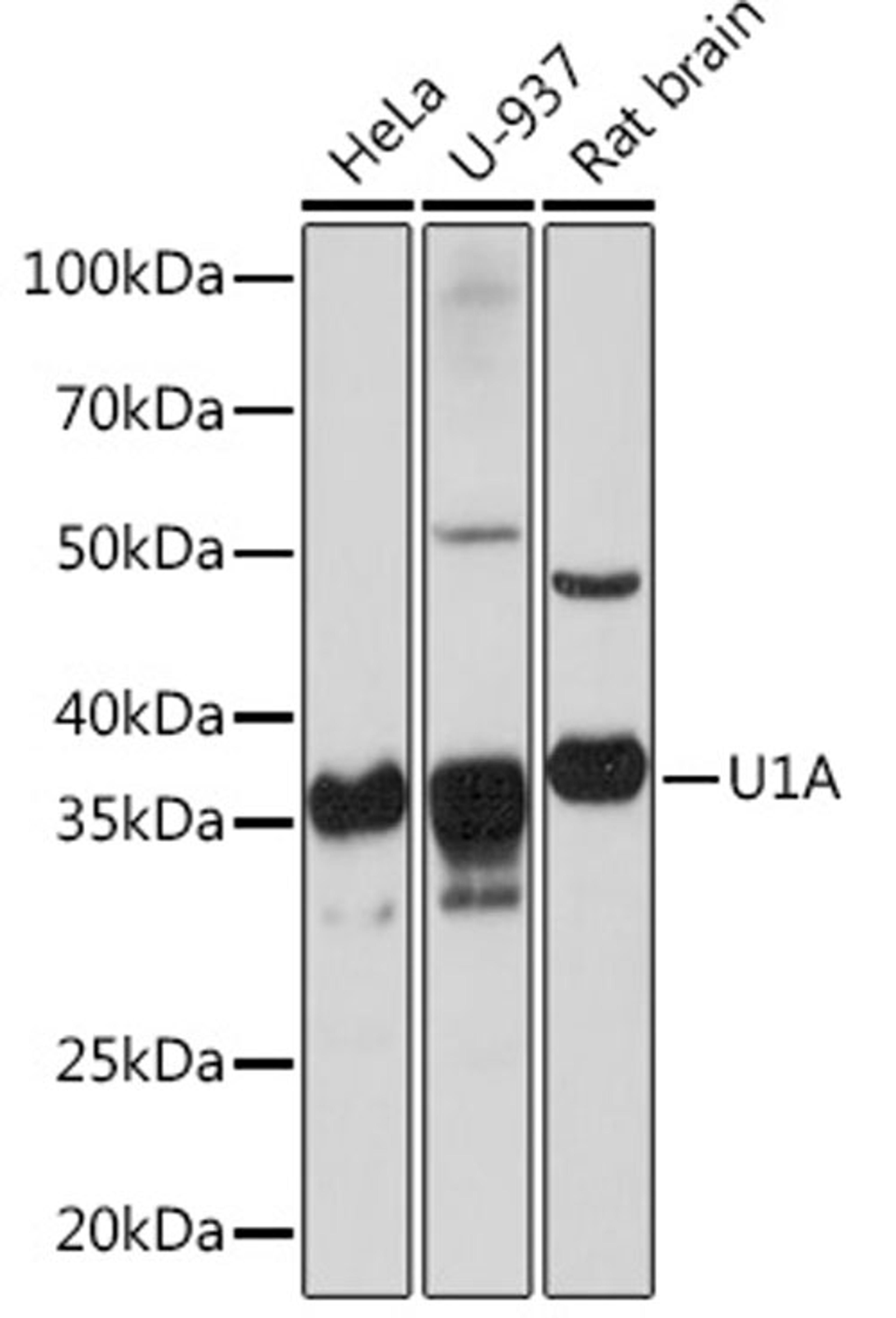 Western blot - U1A Rabbit mAb (A3686)