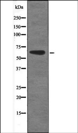 Western blot analysis of EGF treated 293 whole cell lysates using CAMKK1/2 -Phospho-Ser458/495- antibody