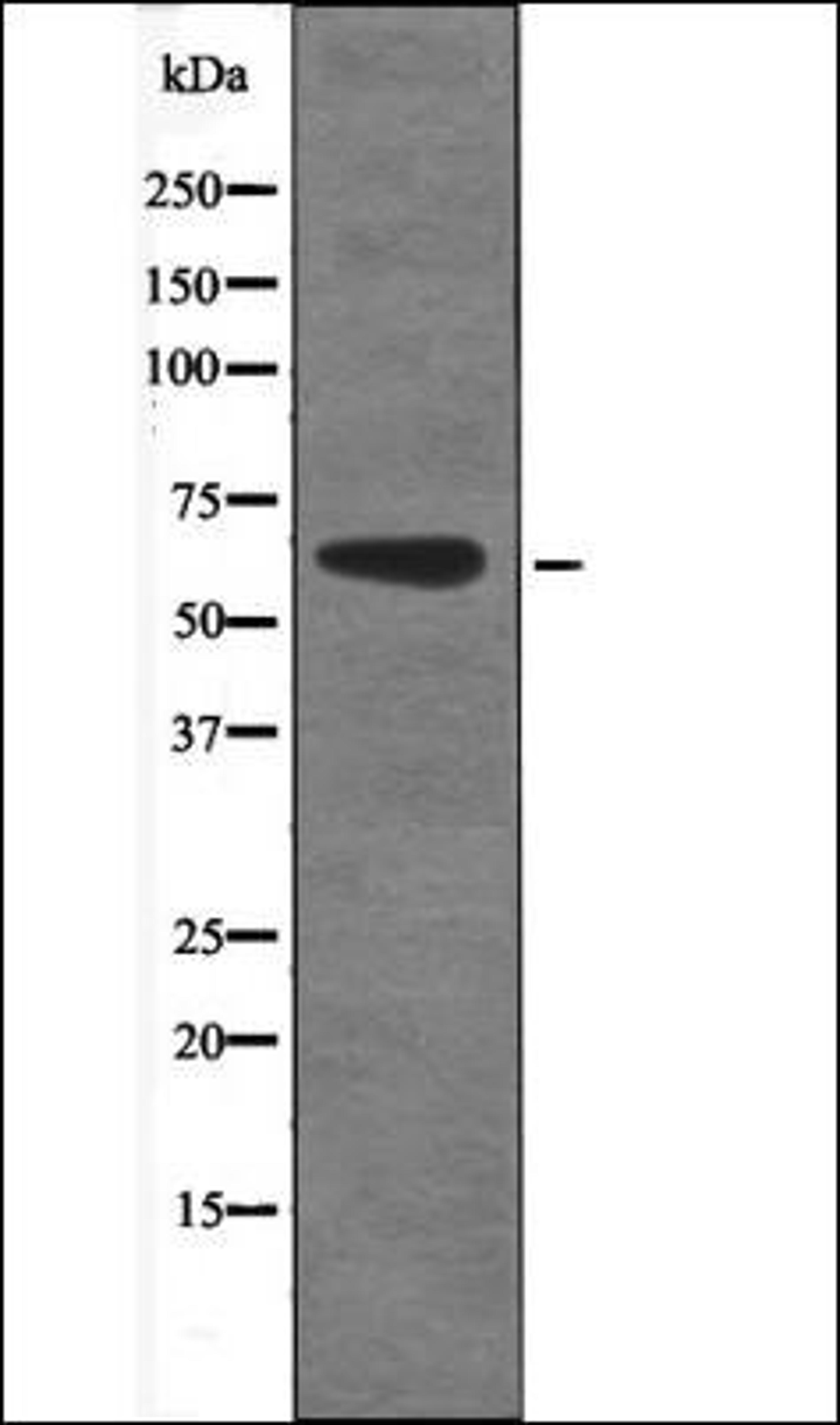 Western blot analysis of EGF treated 293 whole cell lysates using CAMKK1/2 -Phospho-Ser458/495- antibody