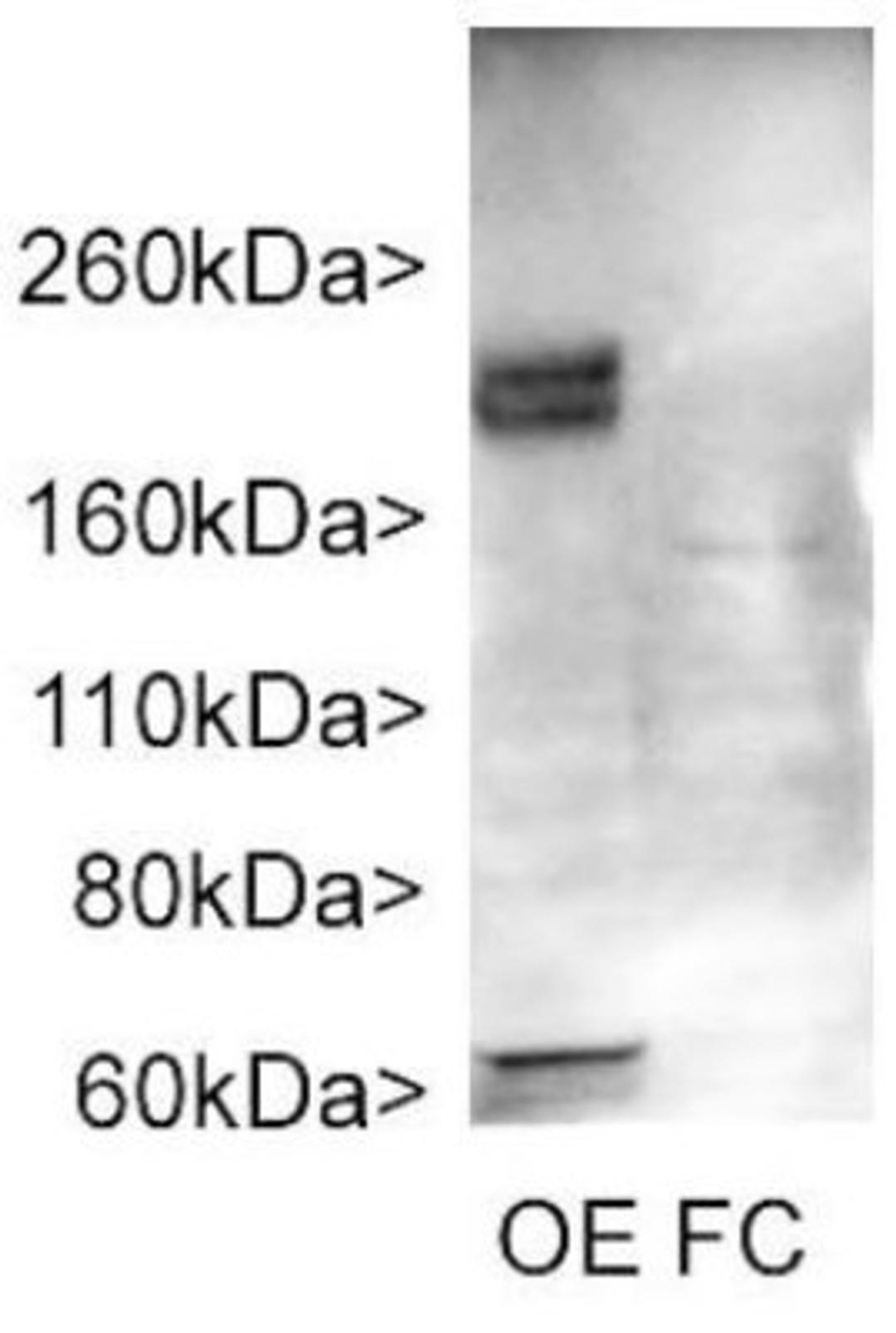 Western Blot: Adenylate Cyclase 3 Antibody [NBP1-92683] - Western blot of rat olfactory epithelium (OE) and frontal cortex (FC). NBP1-92683 stains a band at about 200kDa in olfactory epithelium which is rich in cilia. Fewer cilia are found in frontal cortex, and the protein is less heavily glycosylated, and a less prominent band is seen at about 160kDa. Data generated in the laboratory of Matt Sarkisian in the University of Florida.