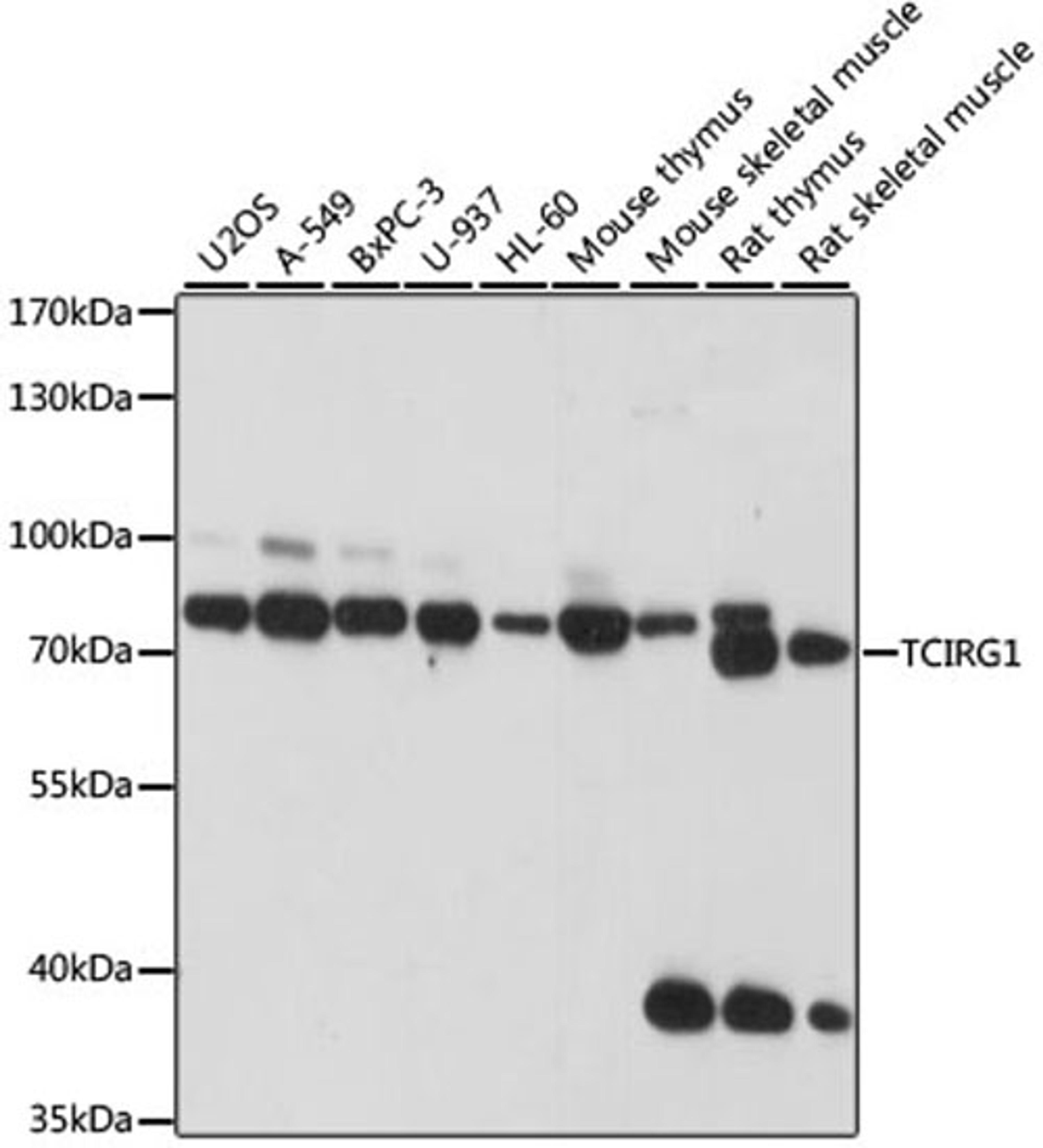 Western blot - TCIRG1 antibody (A15382)