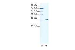 Antibody used in WB on Human HepG2 at 2.5 ug/ml.