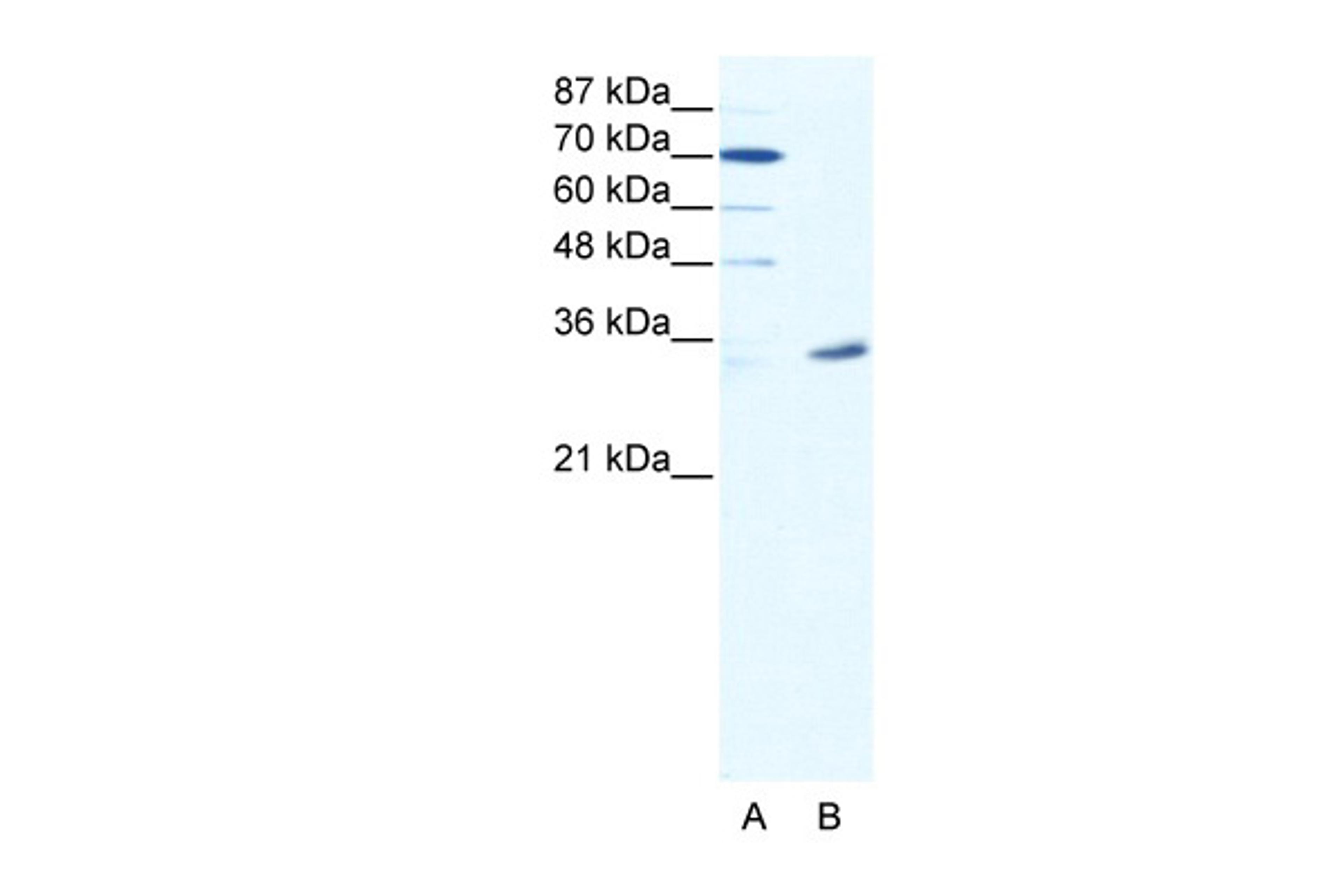 Antibody used in WB on Human HepG2 at 2.5 ug/ml.