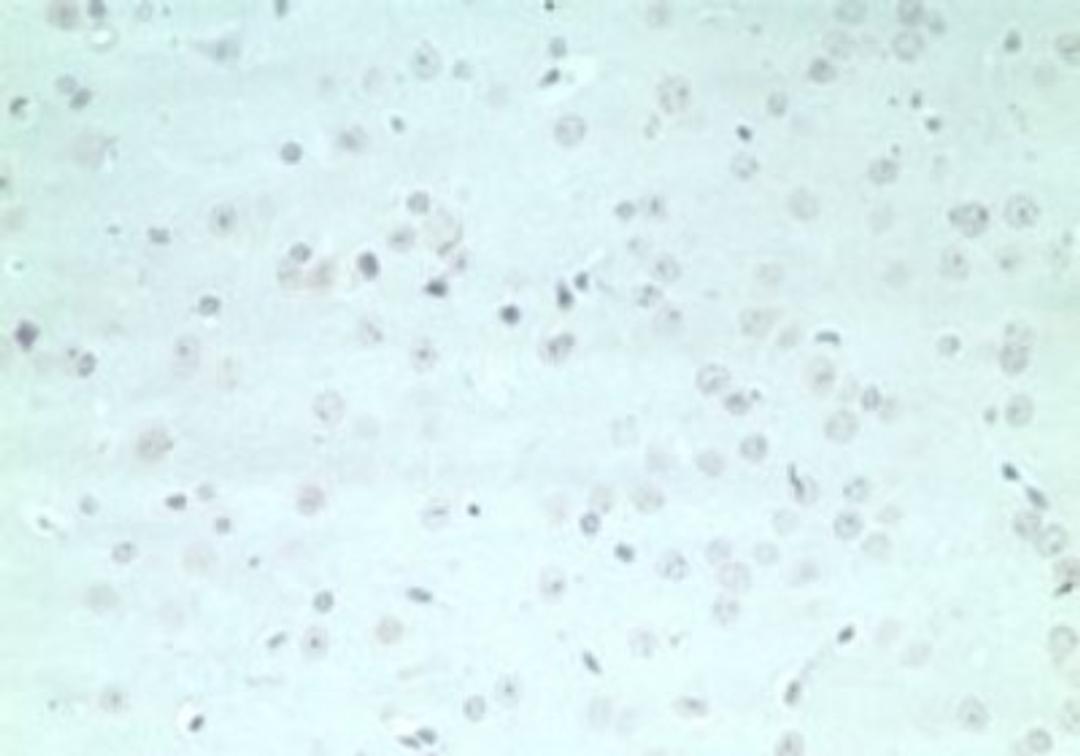 Immunohistochemistry-Paraffin: ARHGAP20 Antibody [NBP2-24757] - IHC staining of mouse brain using control (rabbit Ig) at 5 ug/ml.