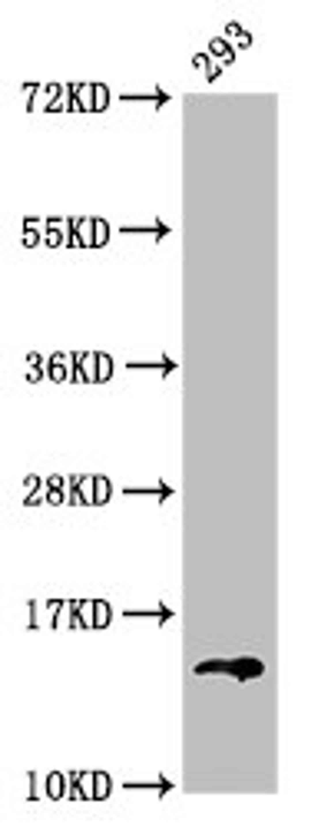 Western Blot. Positive WB detected in: 293 whole cell lysate. All lanes: HIST1H2BC antibody at 0.47µg/ml. Secondary. Goat polyclonal to rabbit IgG at 1/50000 dilution. Predicted band size: 14 kDa. Observed band size: 14 kDa