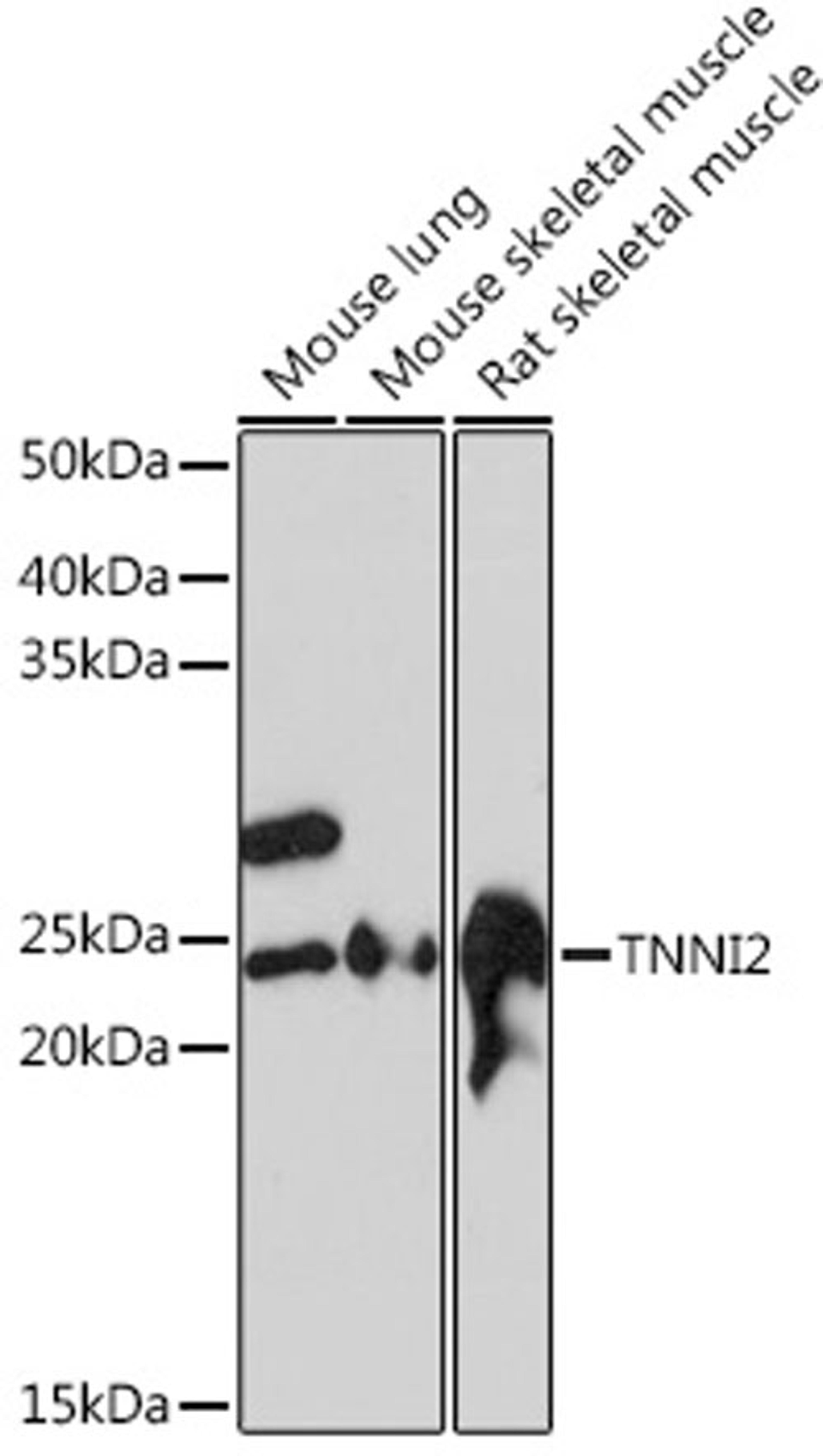 Western blot - TNNI2 Rabbit mAb (A4740)