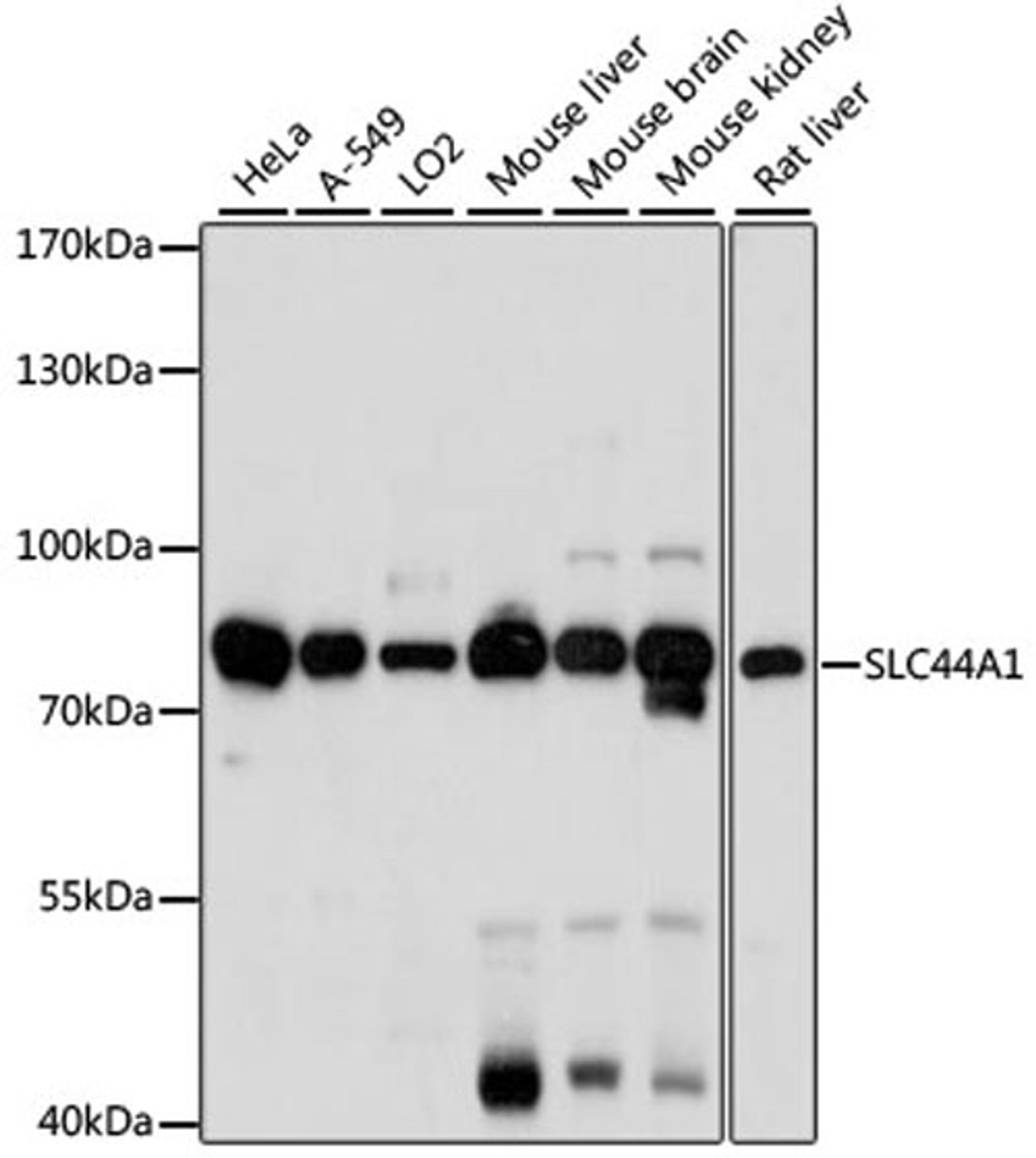 Western blot - SLC44A1 antibody (A15413)