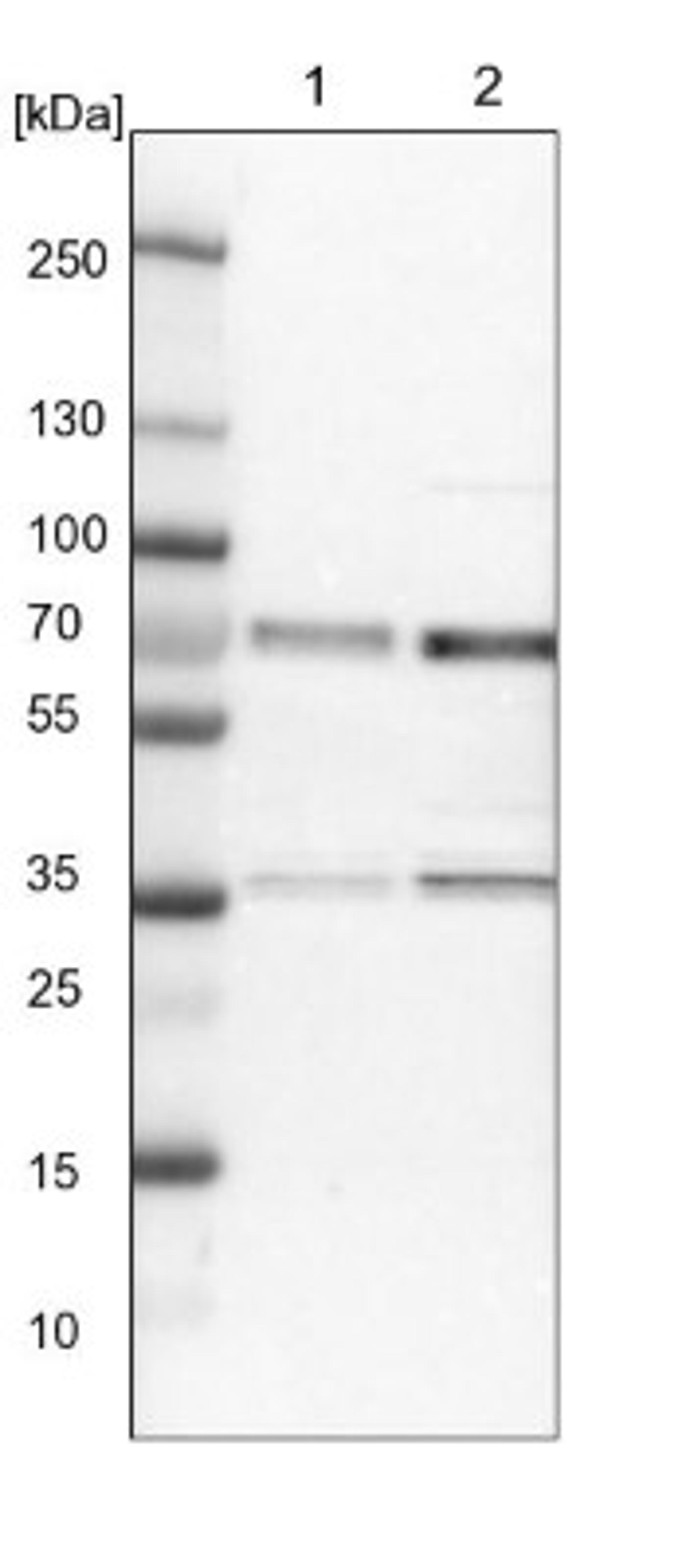 Western Blot: CCDC6 Antibody [NBP1-85351] - Lane 1: NIH-3T3 cell lysate (Mouse embryonic fibroblast cells)<br/>Lane 2: NBT-II cell lysate (Rat Wistar bladder tumour cells)