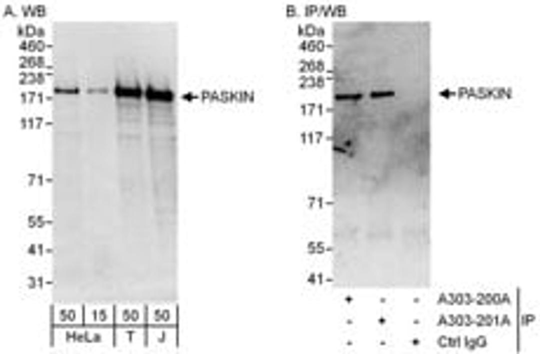 Detection of human PASKIN by western blot and immunoprecipitation.