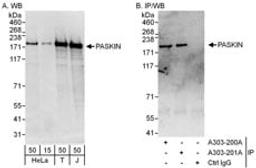 Detection of human PASKIN by western blot and immunoprecipitation.