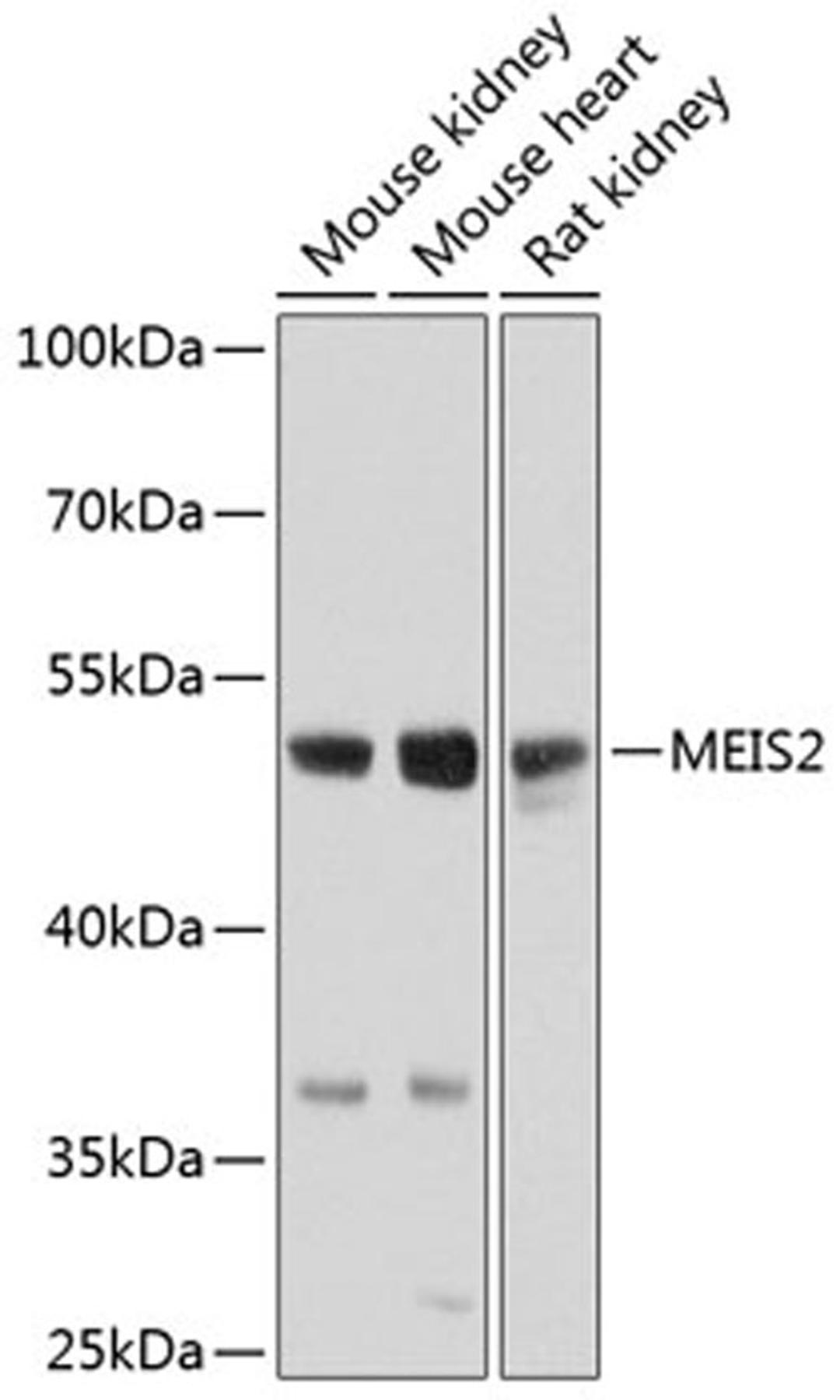 Western blot - MEIS2 antibody (A8437)