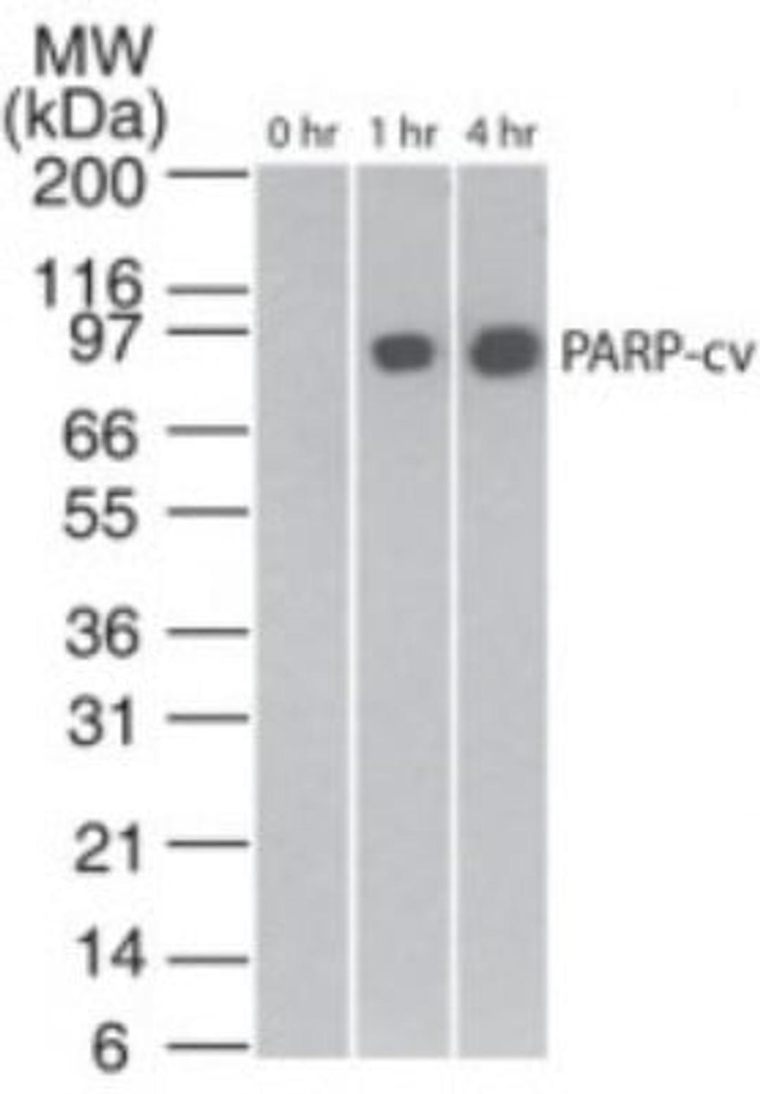 Western Blot: PARP Antibody (194C1439) [Azide Free] [NBP2-27335] - Analysis of cleaved PARP in staurosporine-treated Jurkat cells at various time points, using this antibody. The band corresponding to cleaved PARP is only seen in the treated samples. anti-mouse Ig HRP conjugate was used in this test.