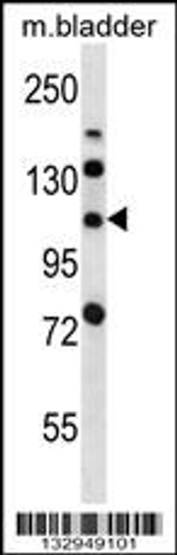 Western blot analysis in mouse bladder tissue lysates (35ug/lane).