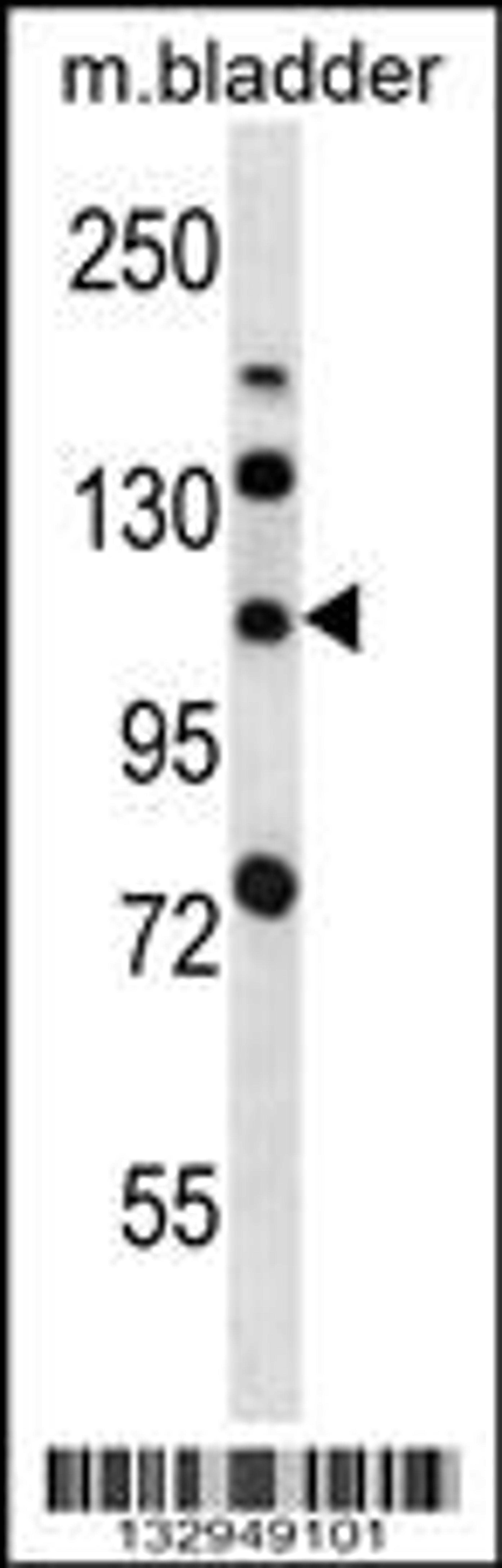 Western blot analysis in mouse bladder tissue lysates (35ug/lane).