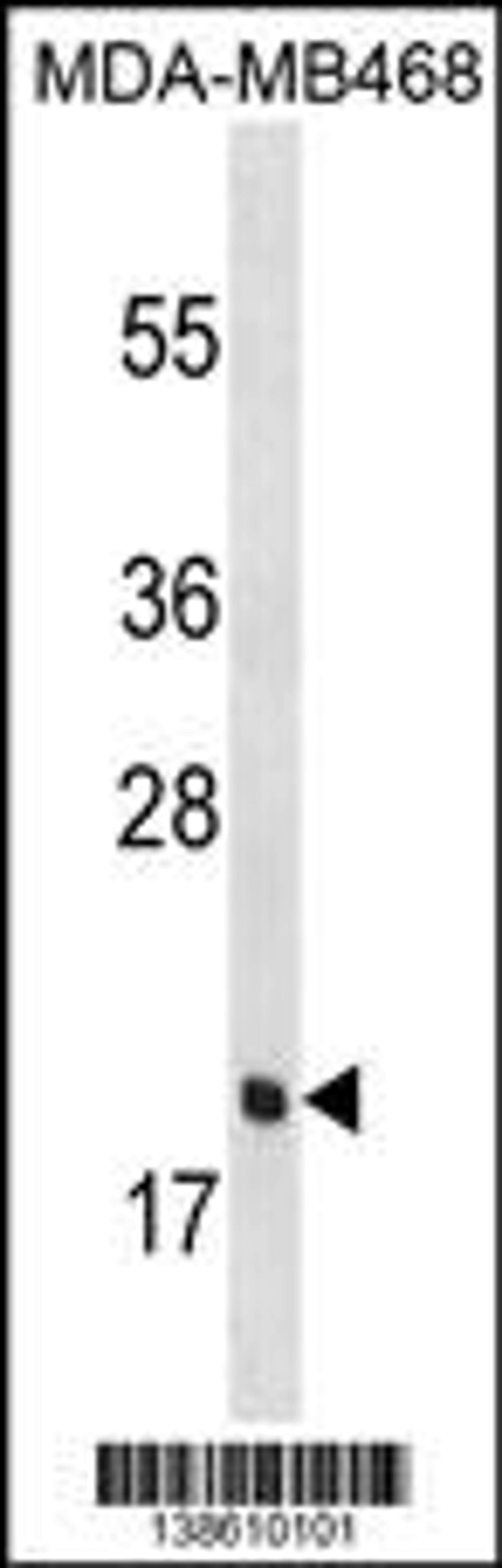 Western blot analysis in MDA-MB468 cell line lysates (35ug/lane).