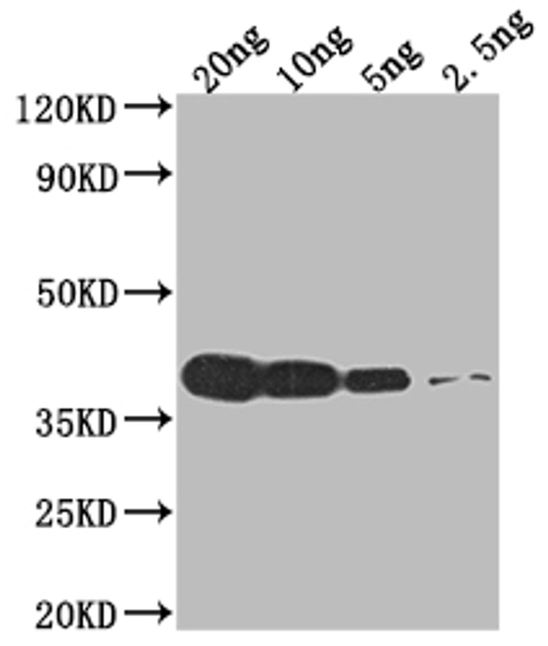 Western Blot. Positive WB detected in Recombinant protein. All lanes: VCATH antibody at 1:2000. Secondary. Goat polyclonal to rabbit IgG at 1/50000 dilution. Predicted band size: 39.9 kDa. Observed band size: 40 kDa. 