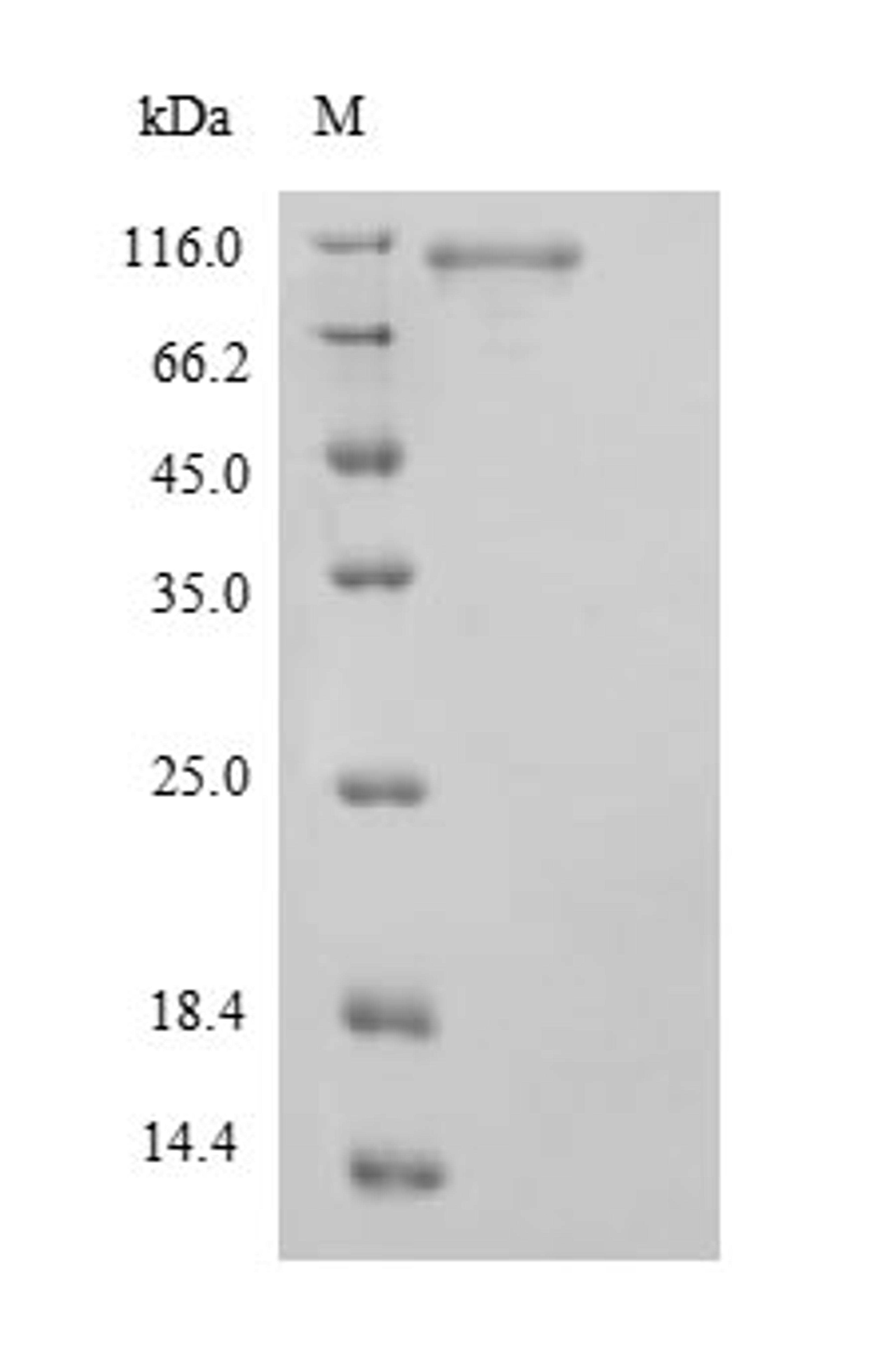 (Tris-Glycine gel) Discontinuous SDS-PAGE (reduced) with 5% enrichment gel and 15% separation gel.