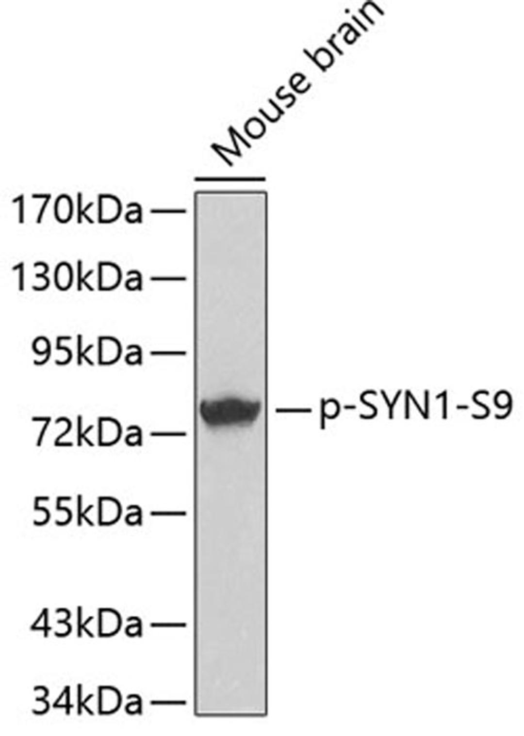 Western blot - Phospho-SYN1-S9 antibody (AP0244)