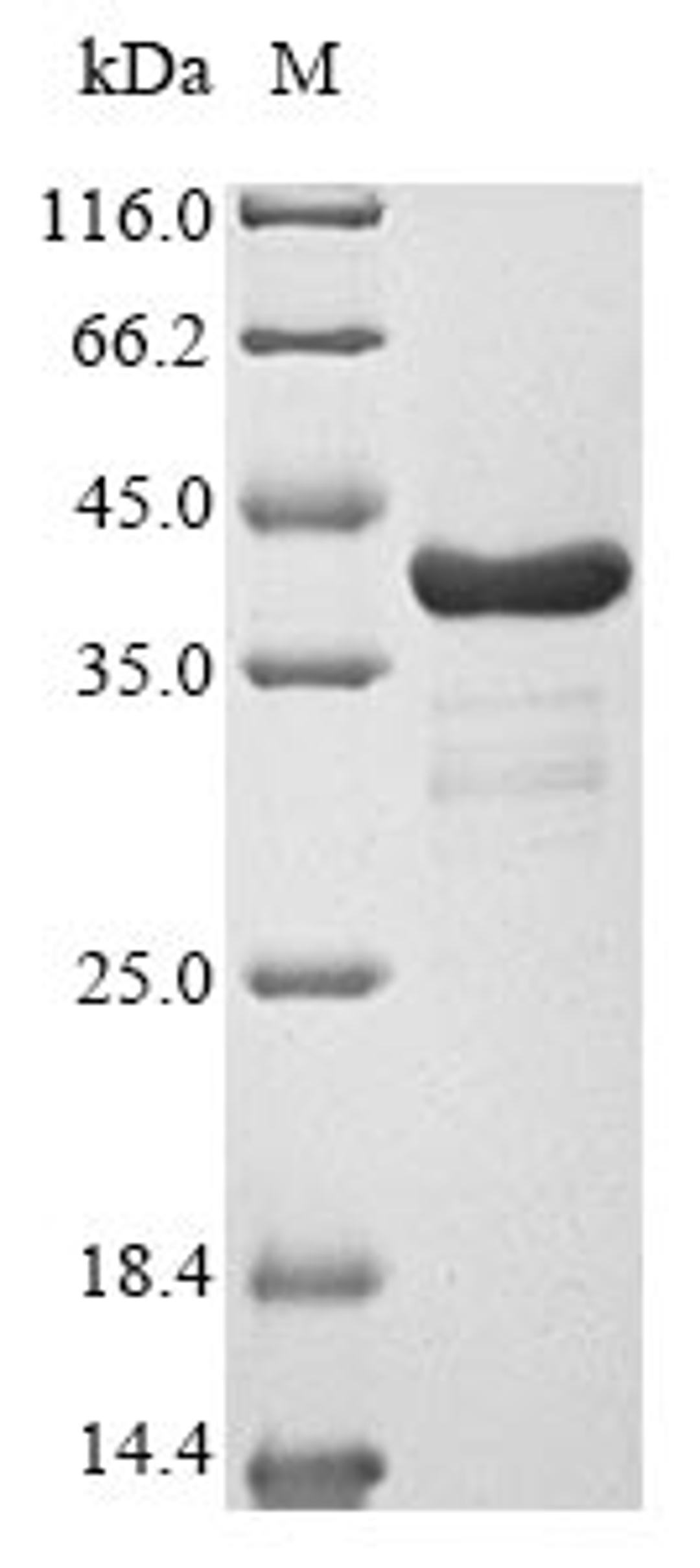 (Tris-Glycine gel) Discontinuous SDS-PAGE (reduced) with 5% enrichment gel and 15% separation gel.