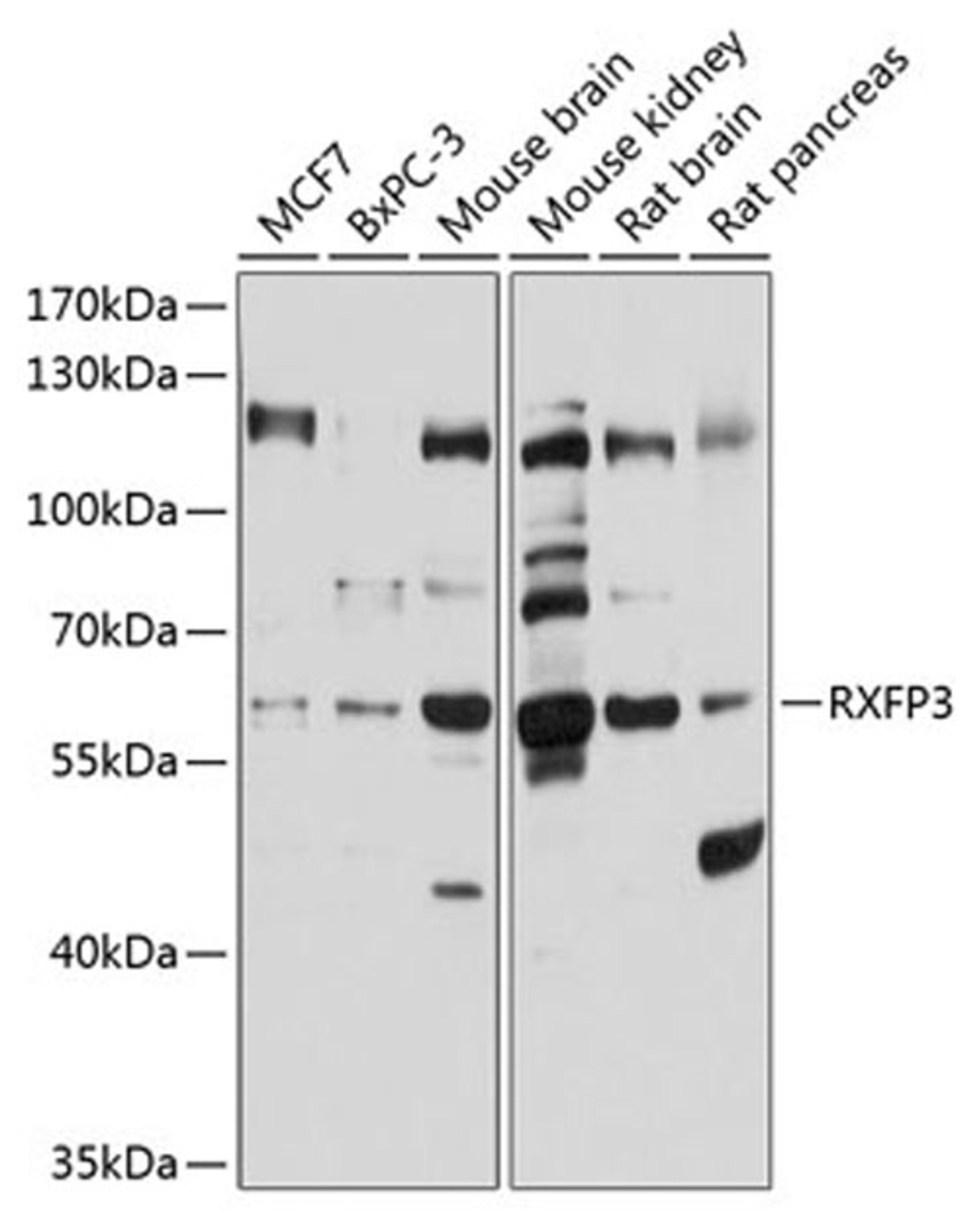 Western blot - RXFP3 antibody (A10303)