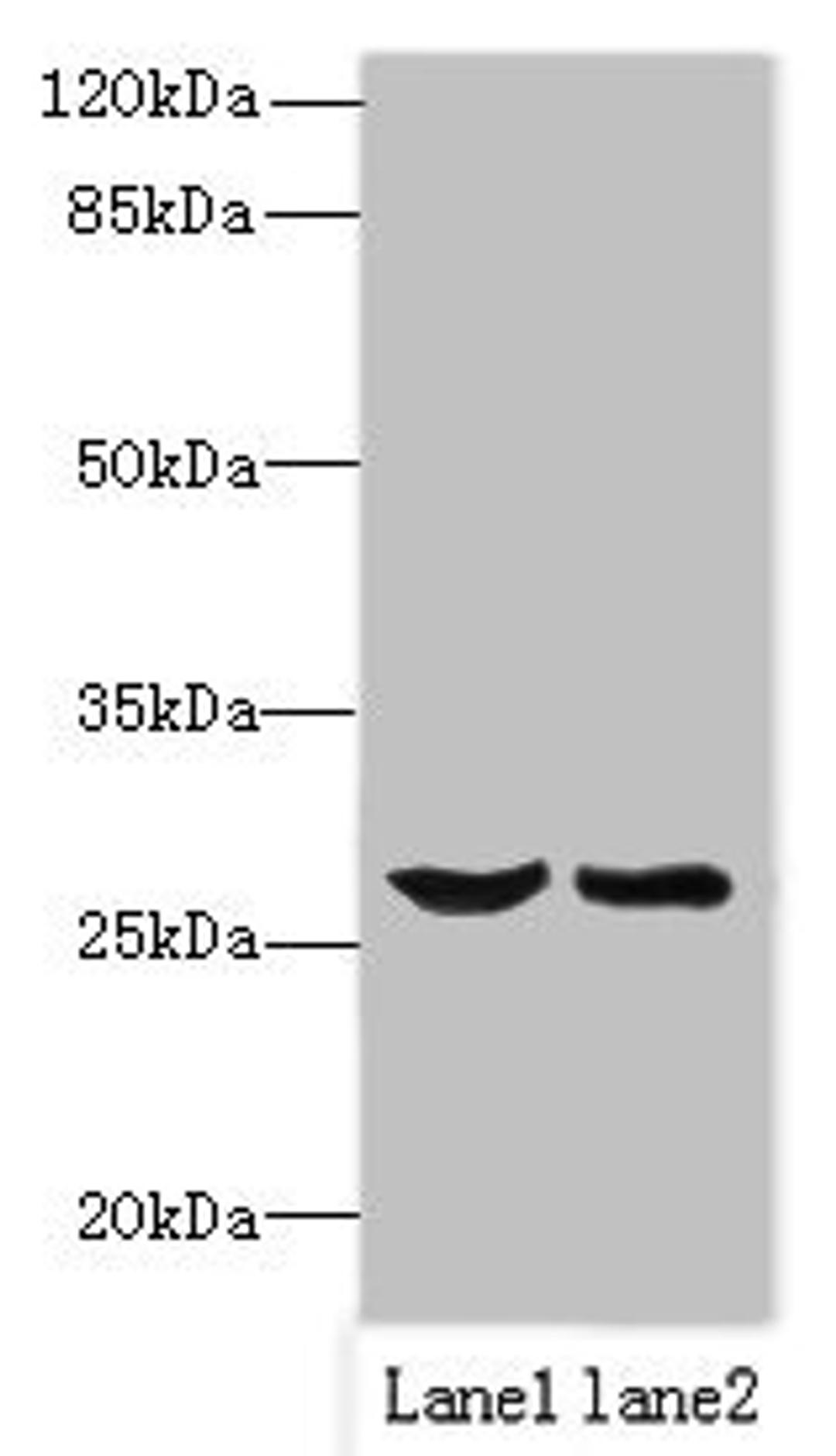 Western blot. All lanes: OCIAD1 antibody at 1ug/ml. Lane 1: Mouse liver tissue. Lane 2: Mouse kidney tissue. Secondary. Goat polyclonal to rabbit IgG at 1/10000 dilution. Predicted band size: 28, 21, 22 kDa. Observed band size: 28 kDa.