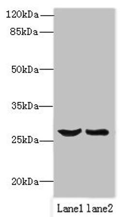 Western blot. All lanes: OCIAD1 antibody at 1ug/ml. Lane 1: Mouse liver tissue. Lane 2: Mouse kidney tissue. Secondary. Goat polyclonal to rabbit IgG at 1/10000 dilution. Predicted band size: 28, 21, 22 kDa. Observed band size: 28 kDa.