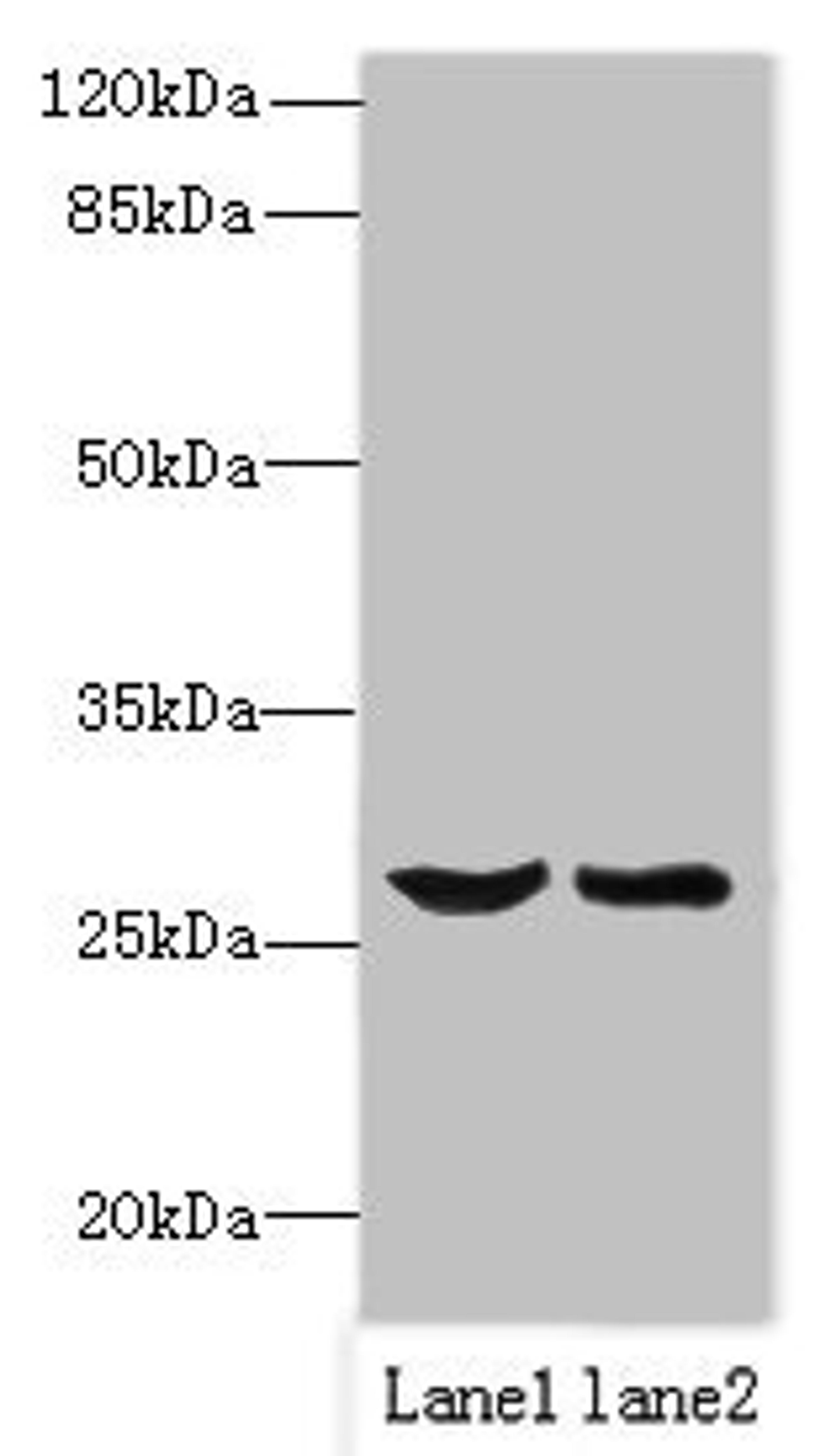 Western blot. All lanes: OCIAD1 antibody at 1ug/ml. Lane 1: Mouse liver tissue. Lane 2: Mouse kidney tissue. Secondary. Goat polyclonal to rabbit IgG at 1/10000 dilution. Predicted band size: 28, 21, 22 kDa. Observed band size: 28 kDa.