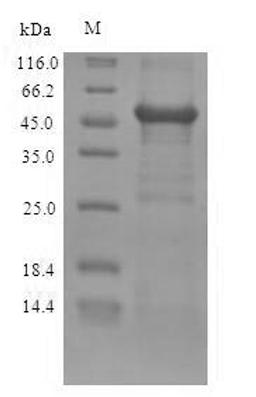 (Tris-Glycine gel) Discontinuous SDS-PAGE (reduced) with 5% enrichment gel and 15% separation gel.
