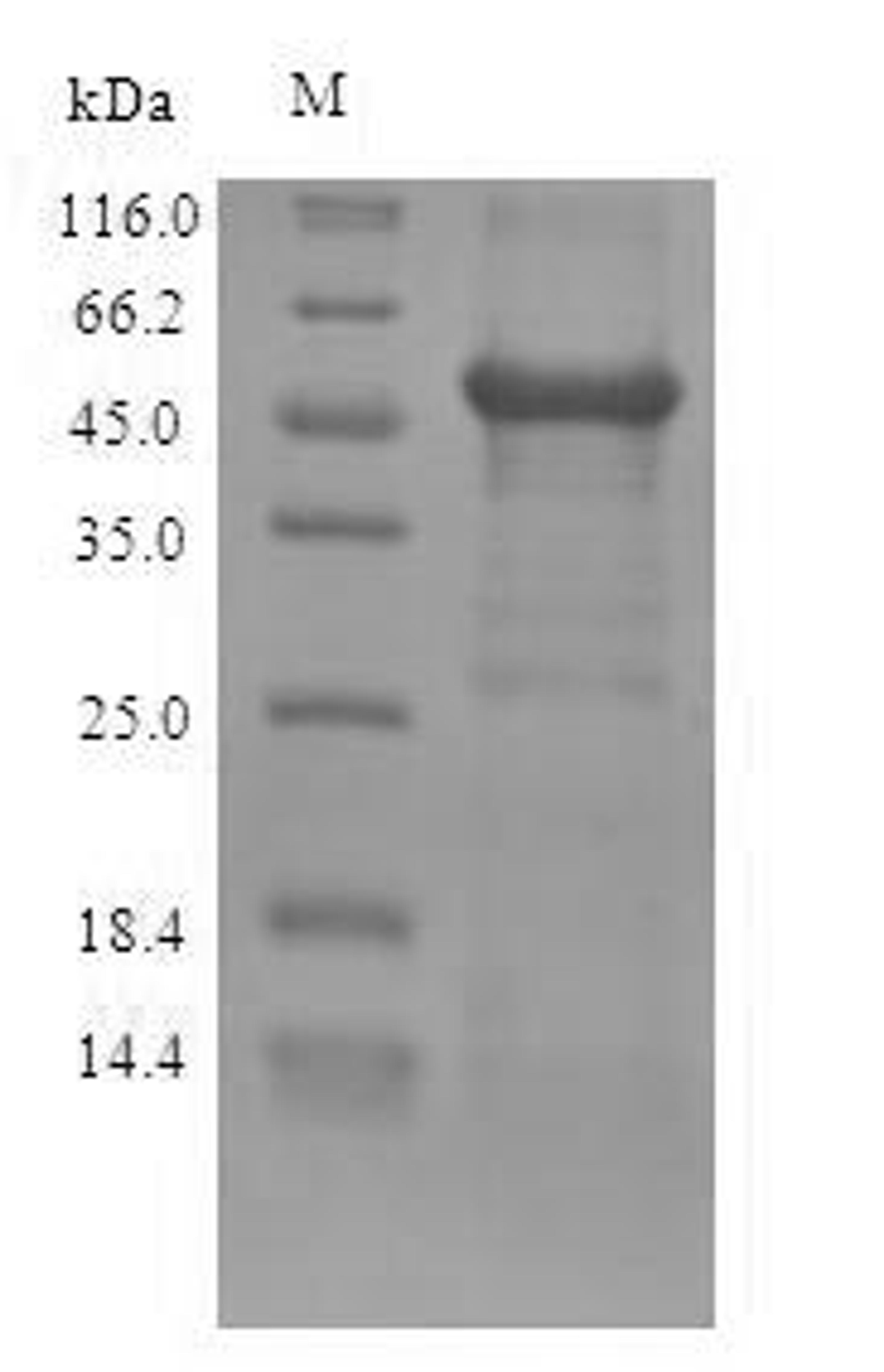 (Tris-Glycine gel) Discontinuous SDS-PAGE (reduced) with 5% enrichment gel and 15% separation gel.