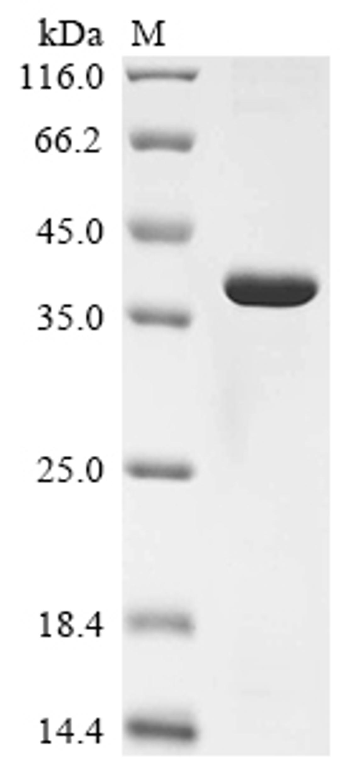 (Tris-Glycine gel) Discontinuous SDS-PAGE (reduced) with 5% enrichment gel and 15% separation gel.