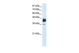 Antibody used in WB on Transfected 293T at 0.2-1 ug/ml.