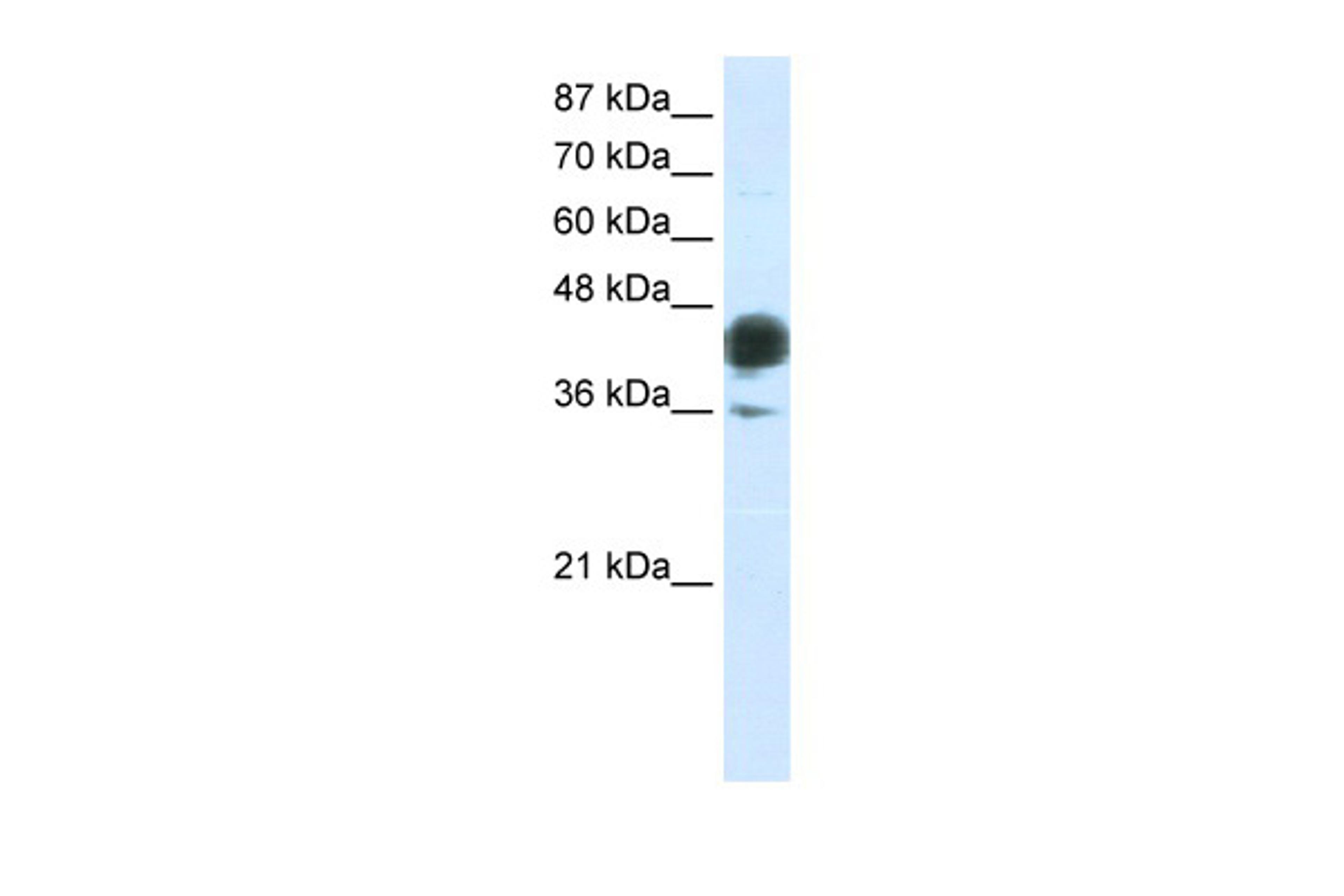 Antibody used in WB on Transfected 293T at 0.2-1 ug/ml.