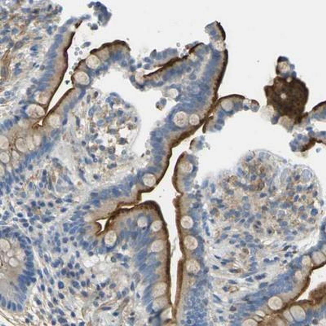 Immunohistochemistry: Mimecan/OIF Antibody [NBP1-87766] - Immunohistochemical staining of human colon shows strong membranous positivity in glandular cells.