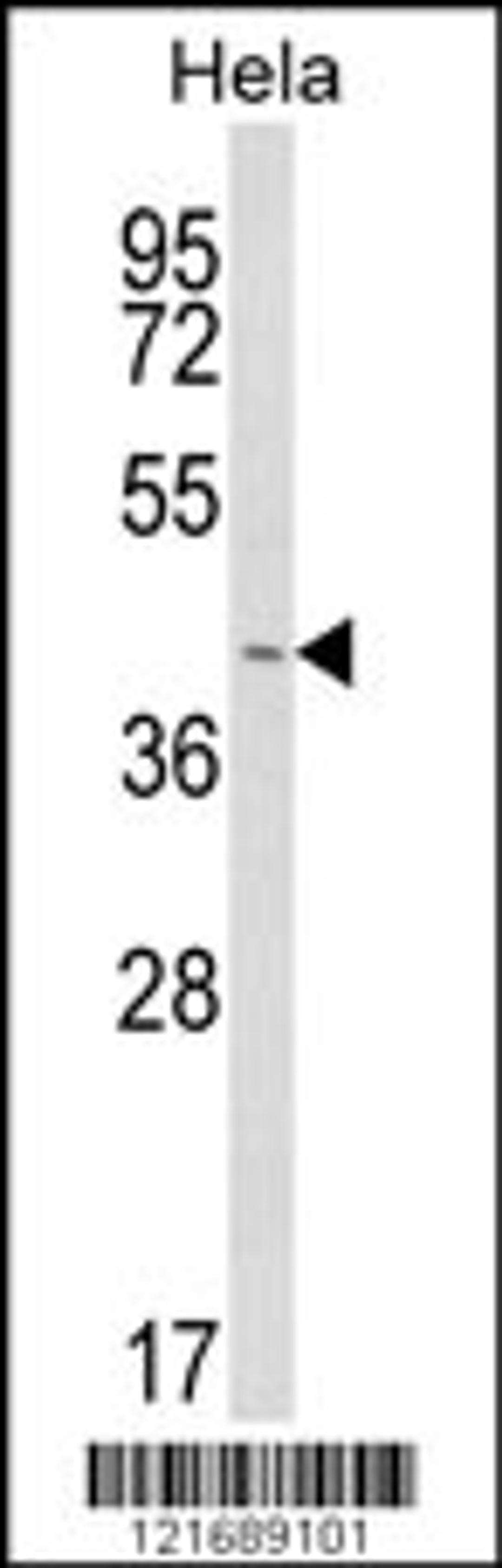 Western blot analysis of INSIG1 Antibody in Hela cell line lysates (35ug/lane)