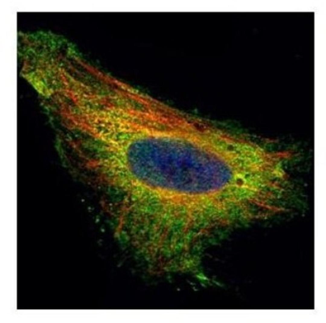 Immunocytochemistry/Immunofluorescence: TIP30 Antibody [NBP2-20646] - Confocal immunofluorescence analysis of paraformaldehyde-fixed HeLa, using TIP30 antibody (Green) at 1:500 dilution. Alpha-tubulin filaments are labeled with Alpha-tubulin antibody (Red) at 1:2000.