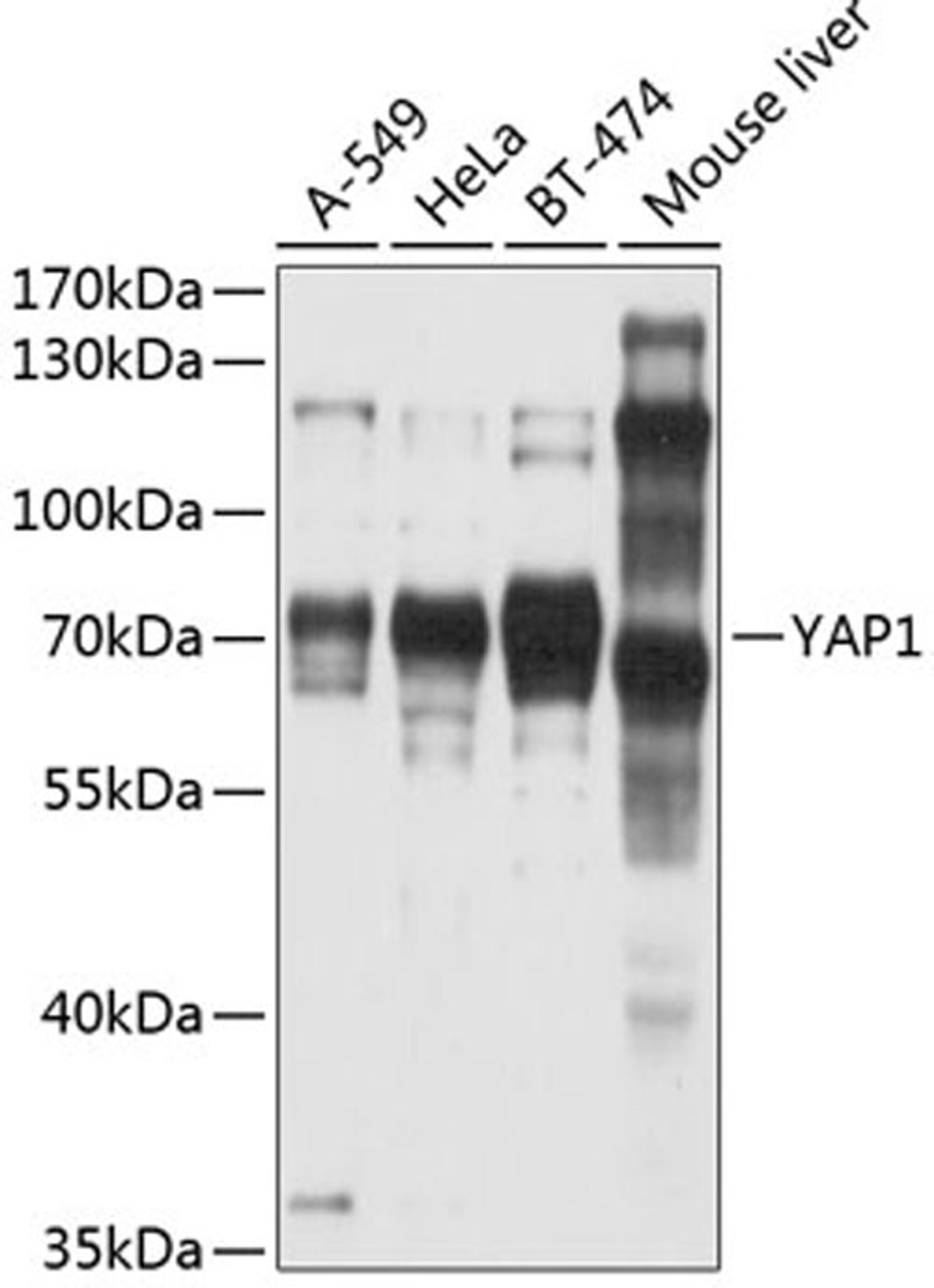 Western blot - YAP1 antibody (A11264)